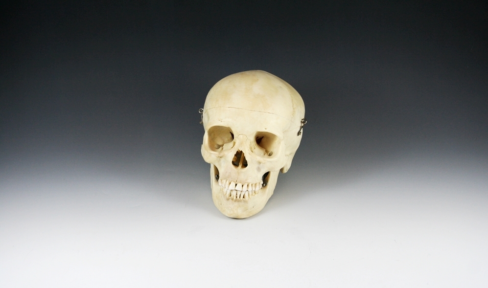 Authentic Human Medical Skull