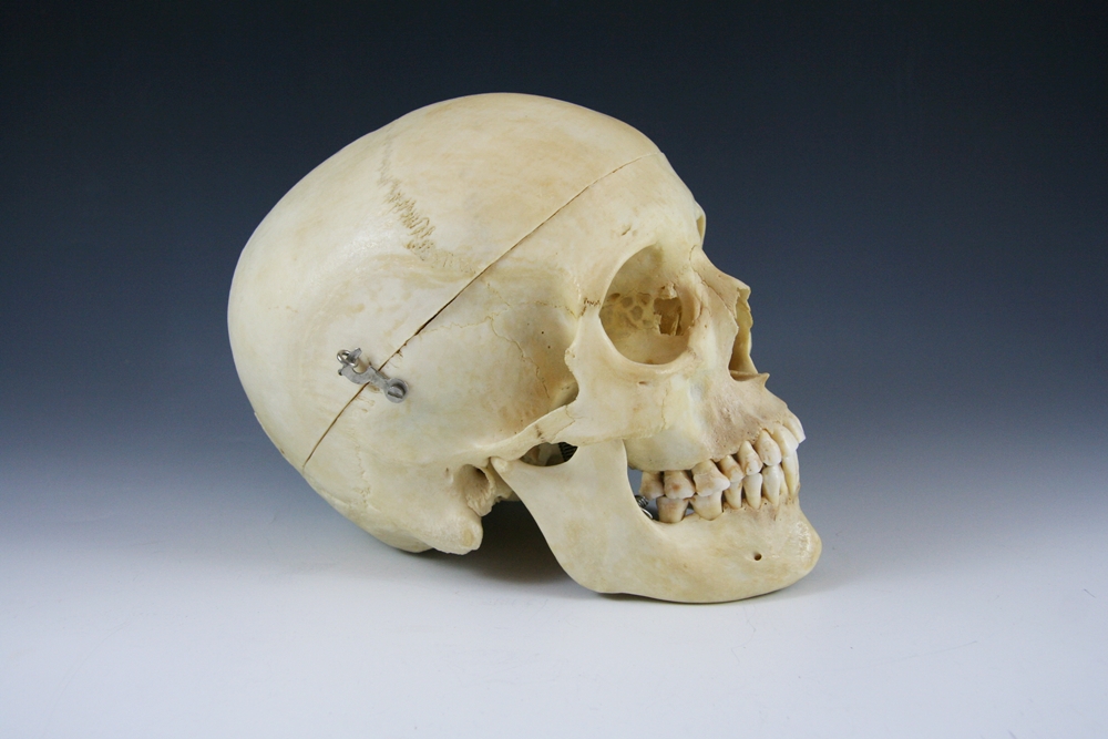Authentic Human Medical Skull
