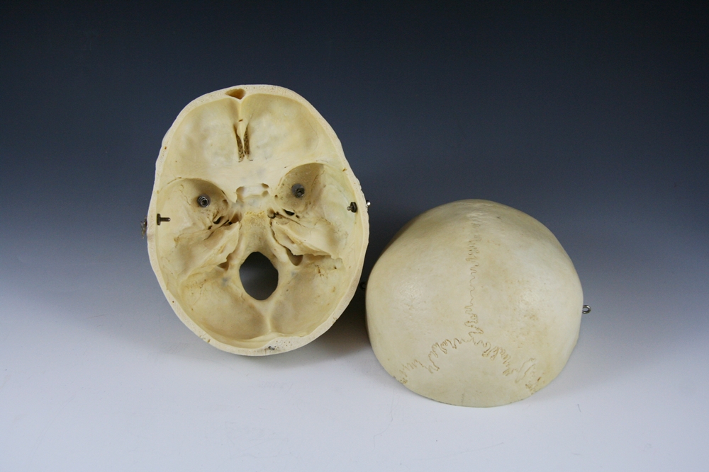 Authentic Human Medical Skull