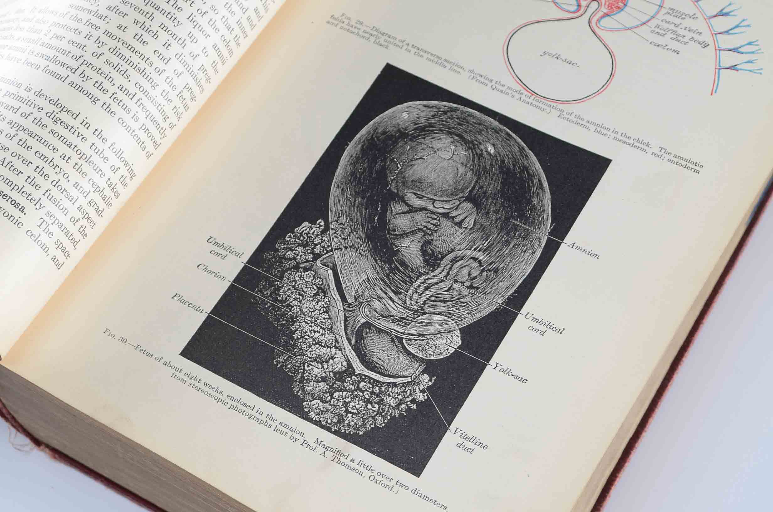 1918 Hardcover Edition of "Anatomy of The Human Body"