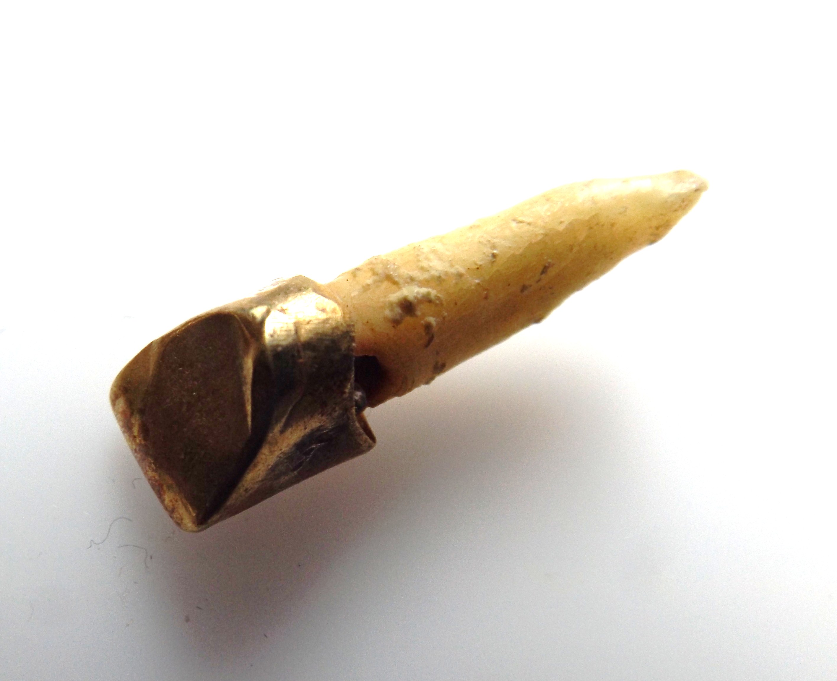 Victorian Jewelry, Vintage Watches, Mexican Bracelet, Gold Tooth