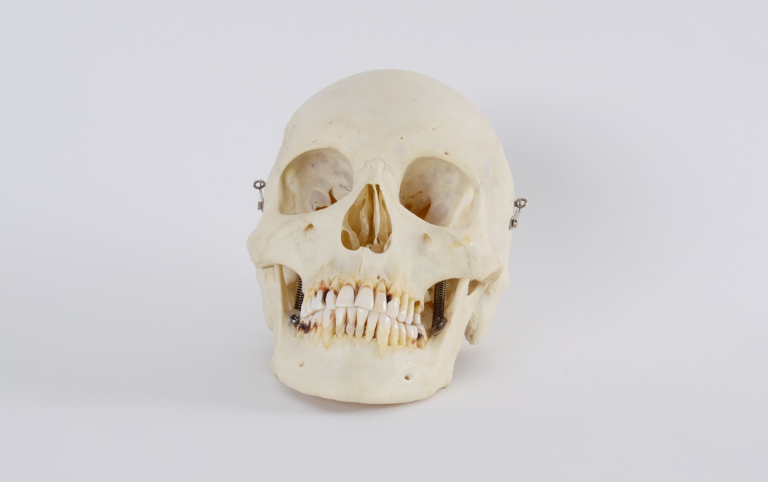 Authentic Human Skull
