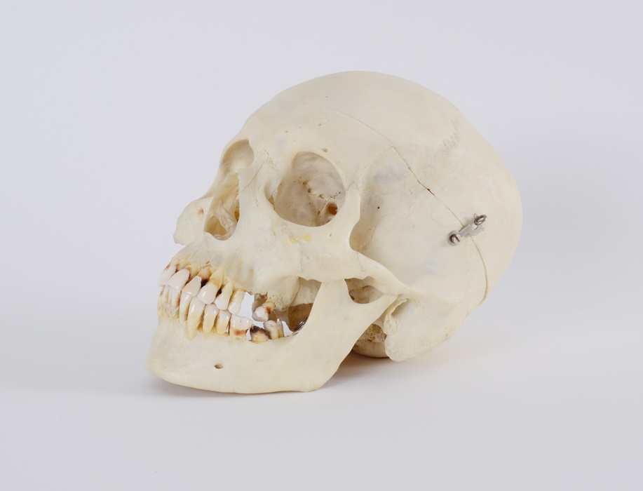 Authentic Human Skull