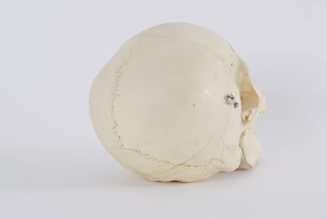 Authentic Human Skull