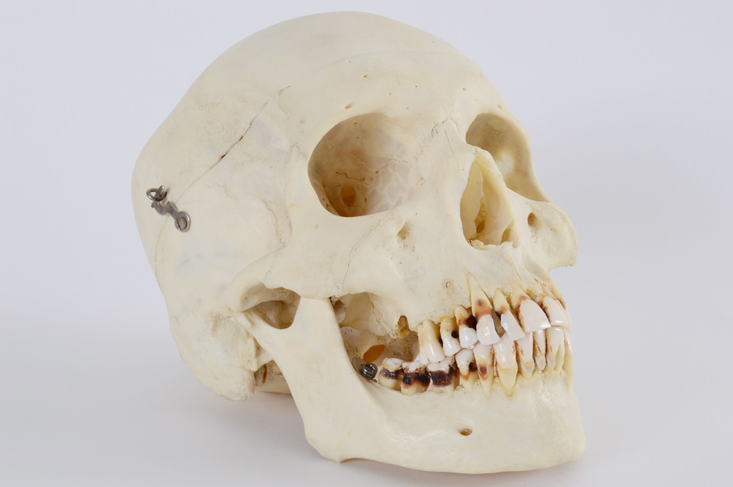 Authentic Human Skull