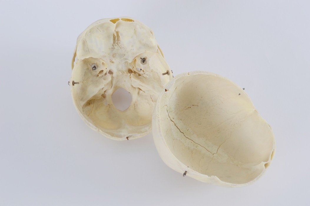 Authentic Human Skull