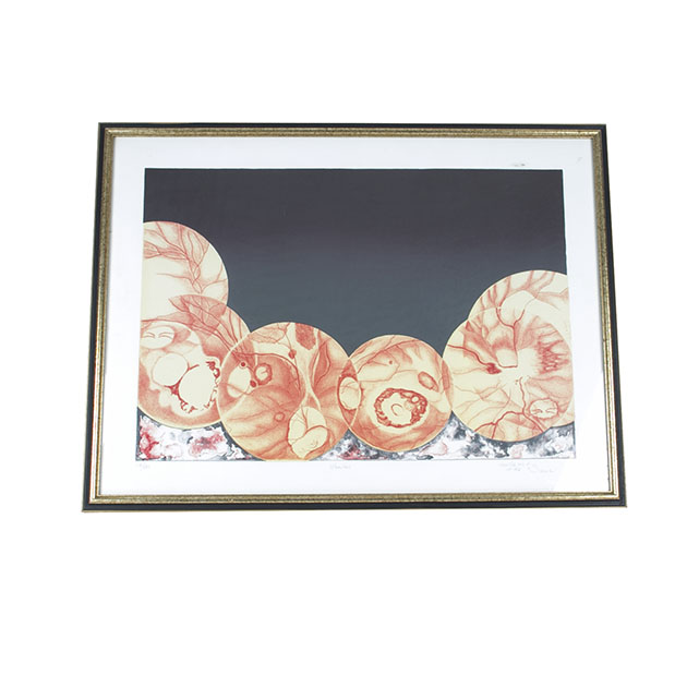 Cecilia M. T.  Suzuki "Uveites" Screen Print