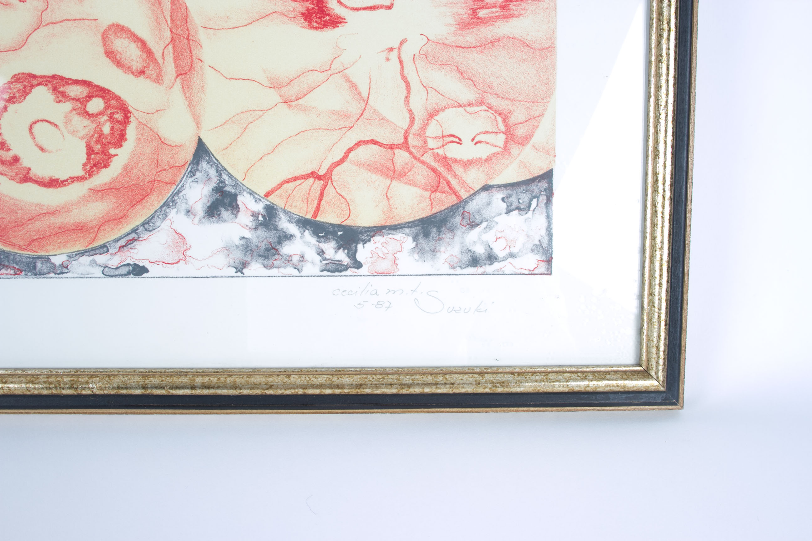 Cecilia M. T.  Suzuki "Uveites" Screen Print