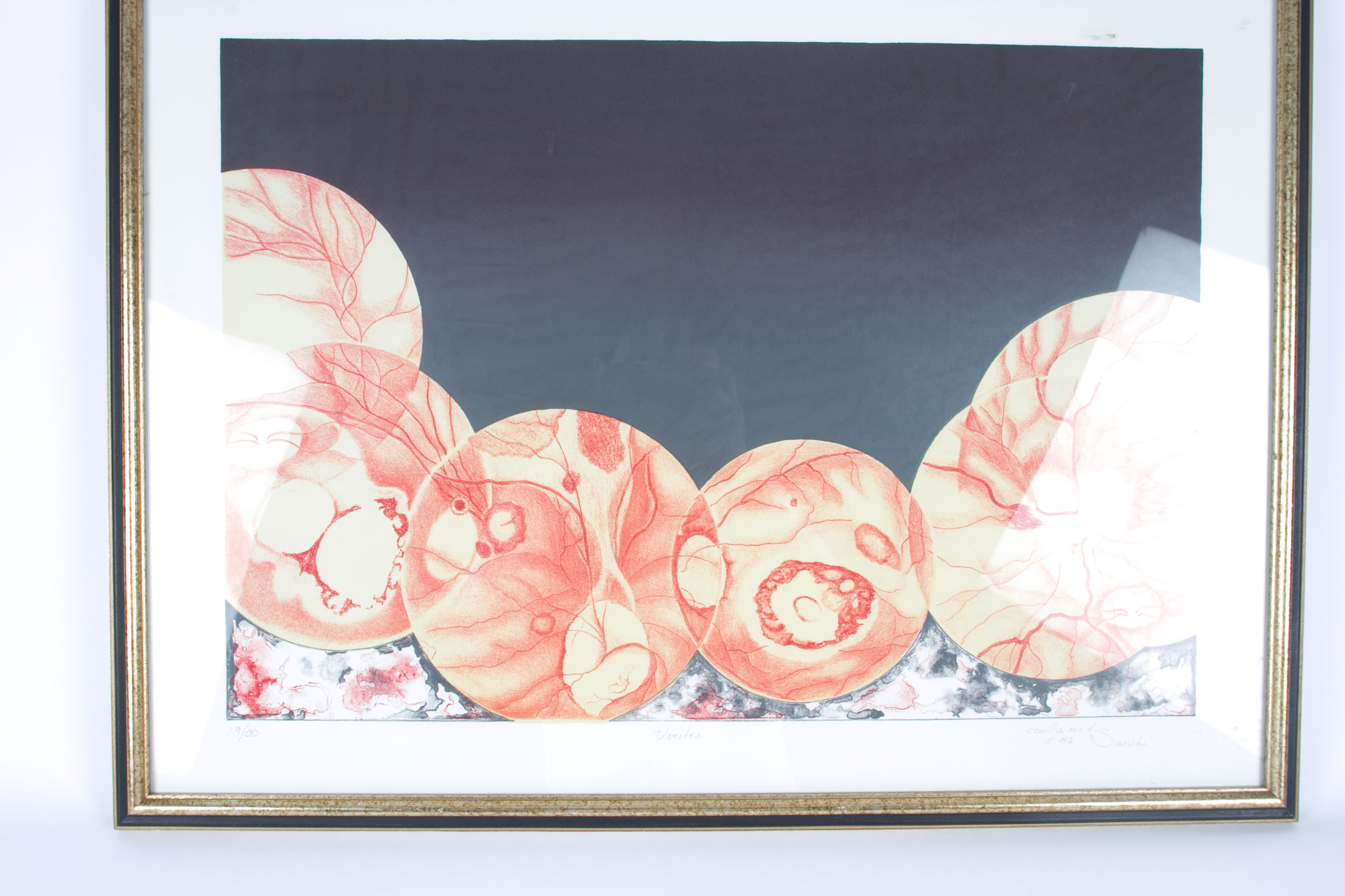 Cecilia M. T.  Suzuki "Uveites" Screen Print