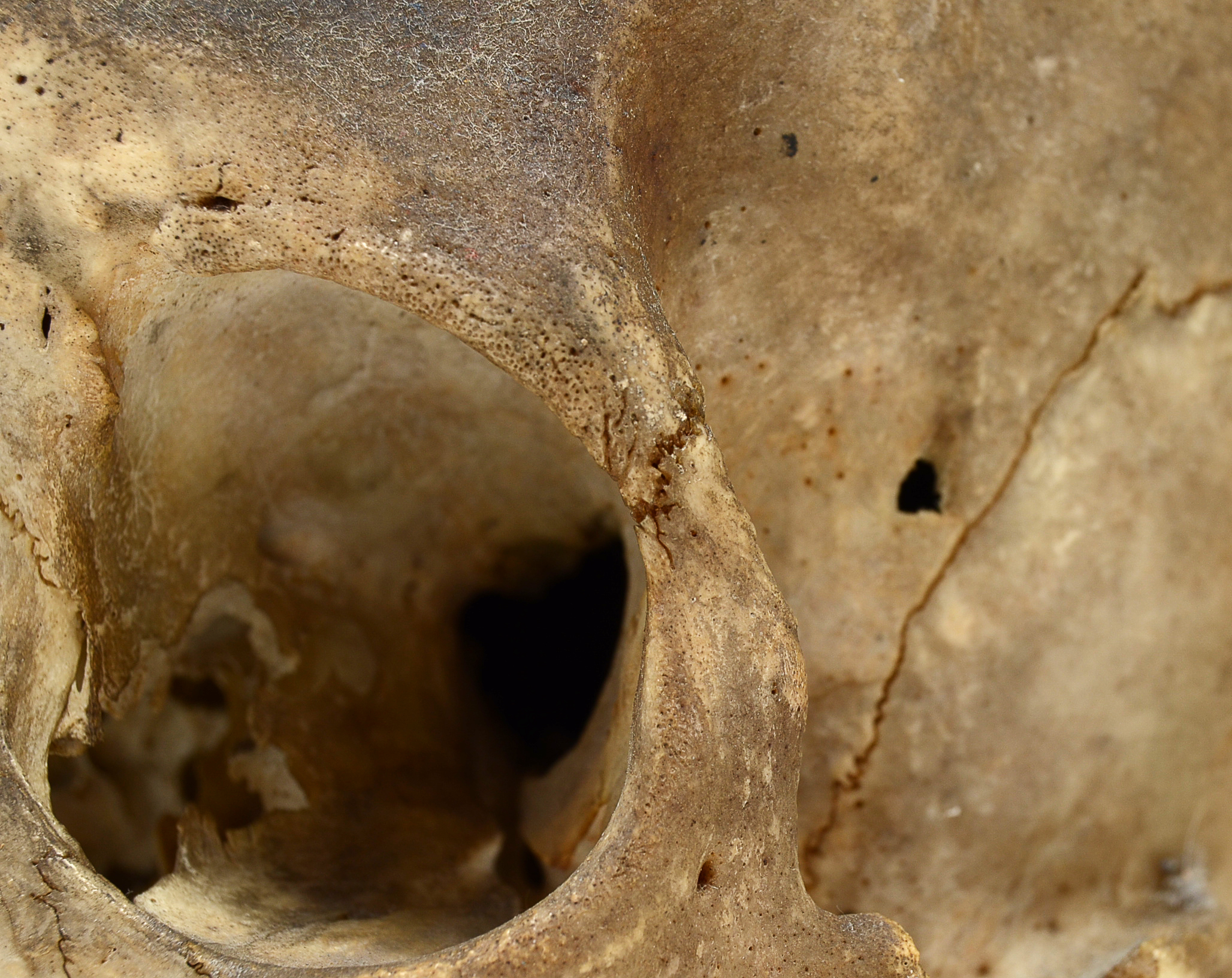 Authentic Human Skull with Hinged Opening