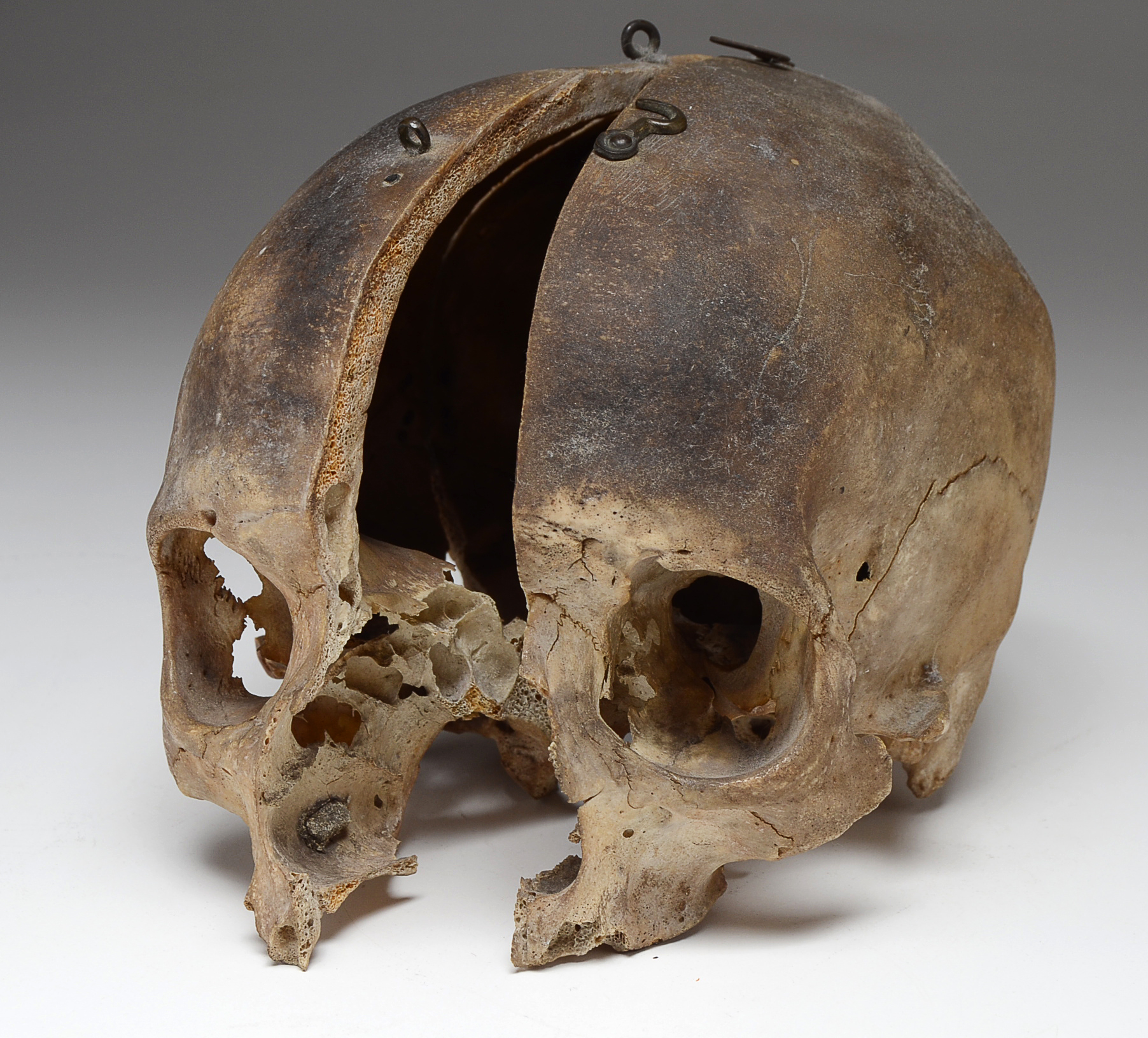 Authentic Human Skull with Hinged Opening