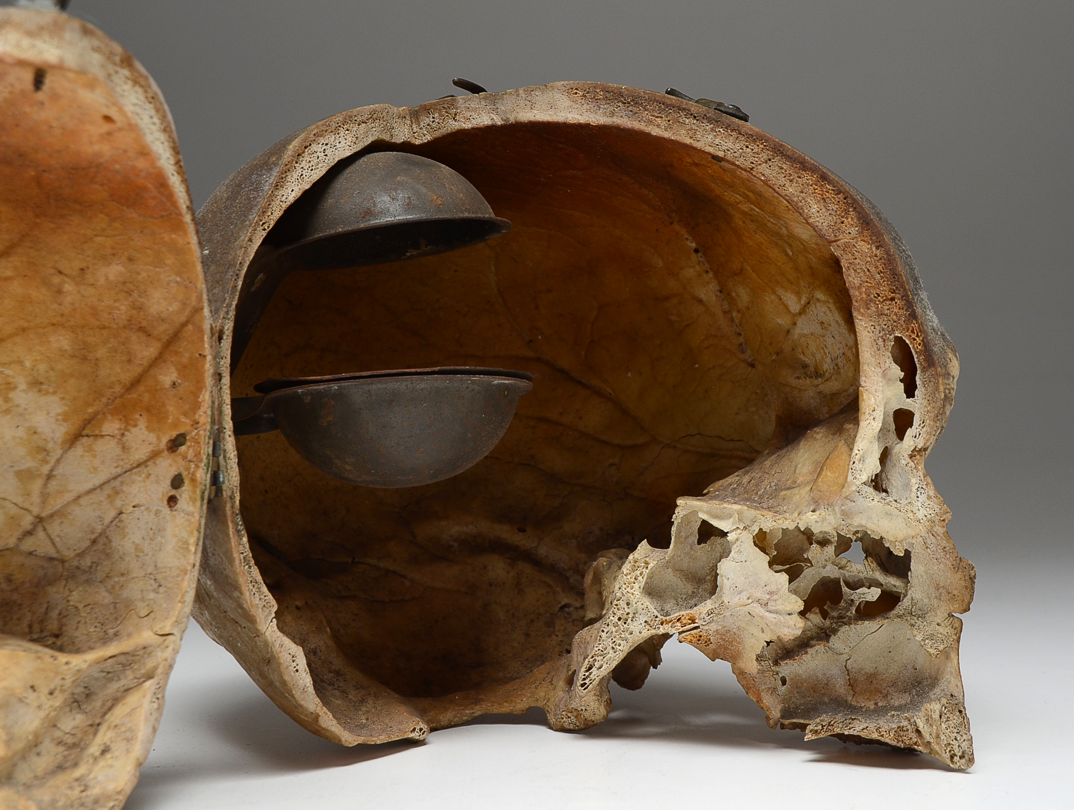 Authentic Human Skull with Hinged Opening