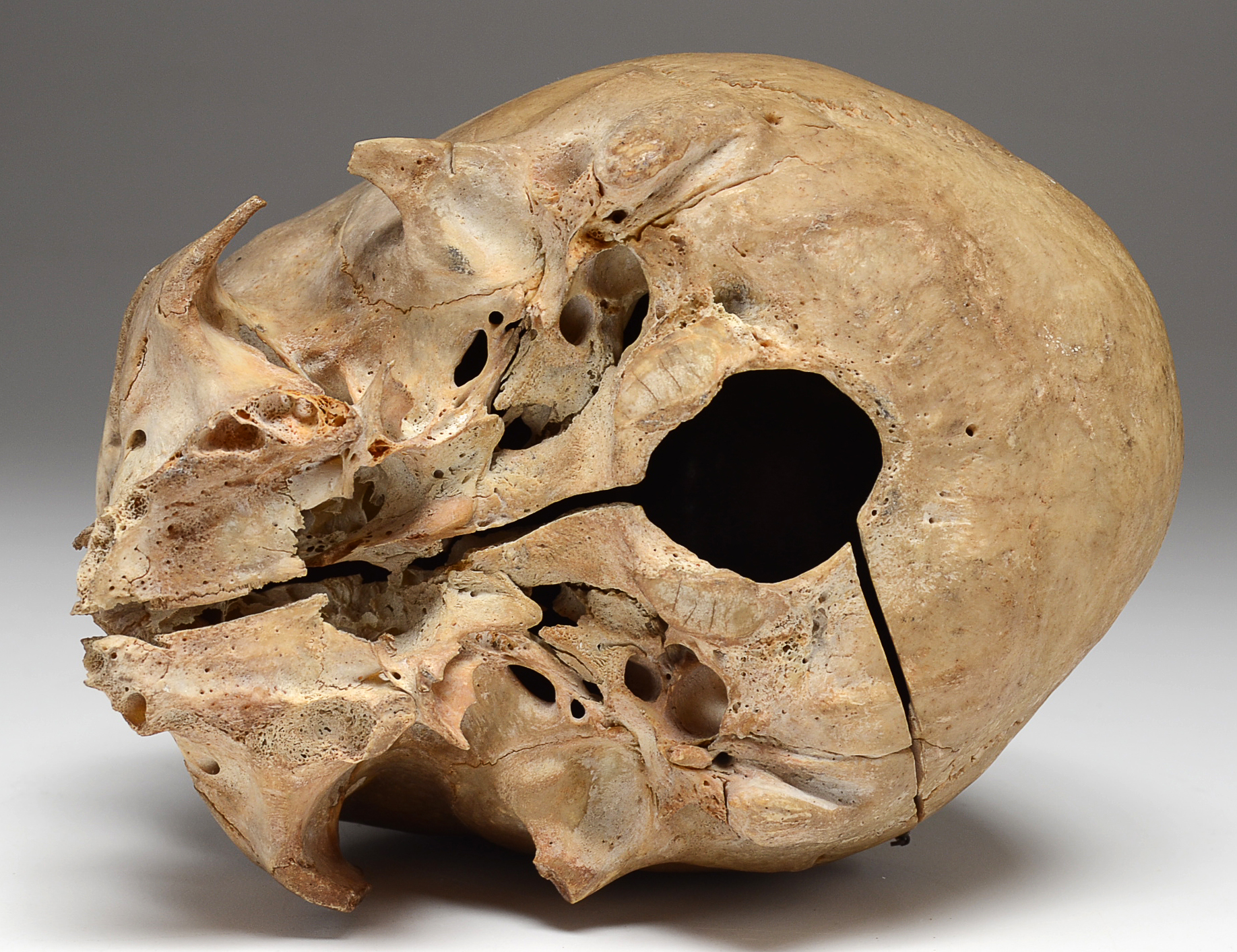 Authentic Human Skull with Hinged Opening