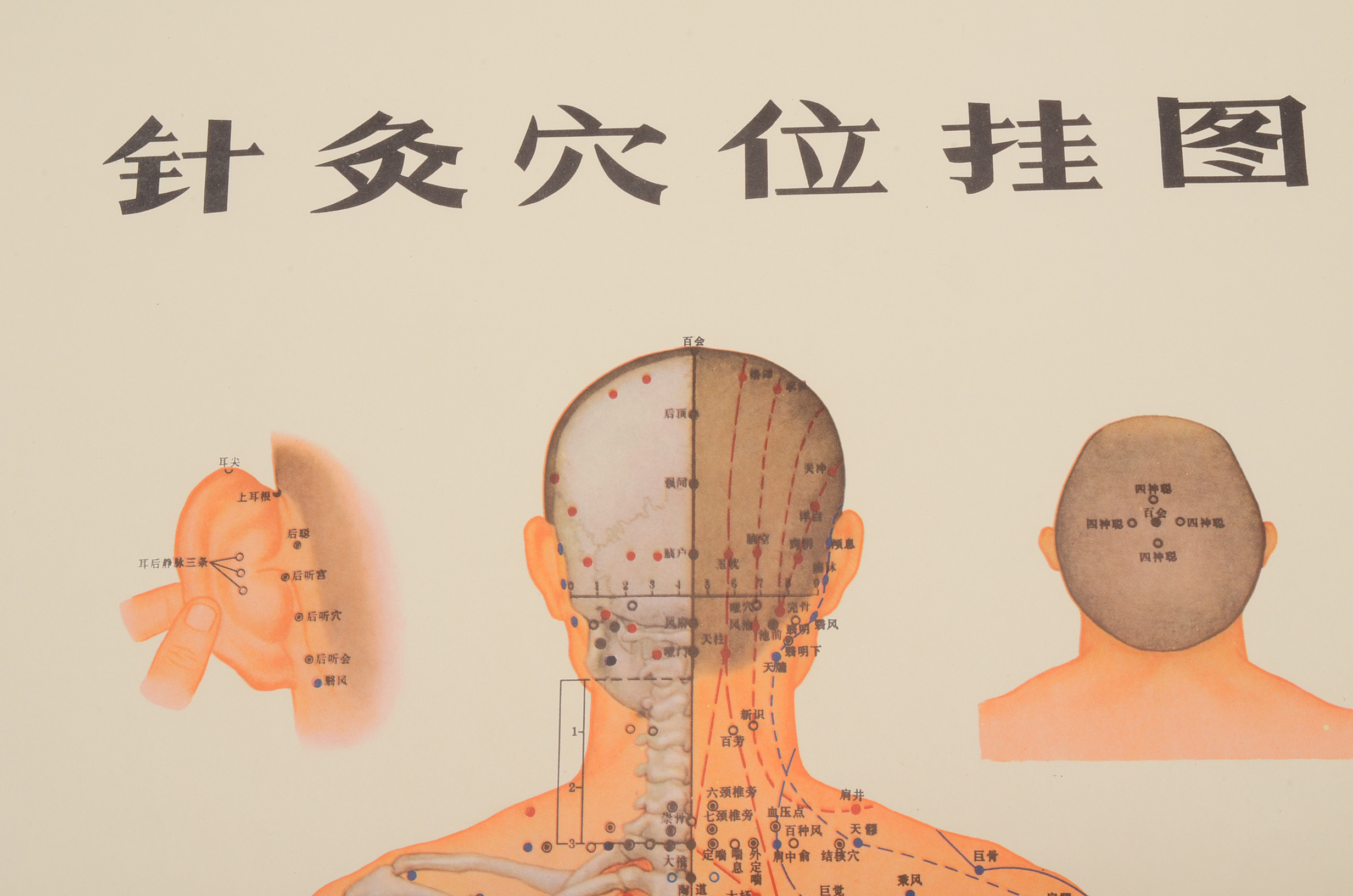 Vintage Chinese Acupuncture Chart