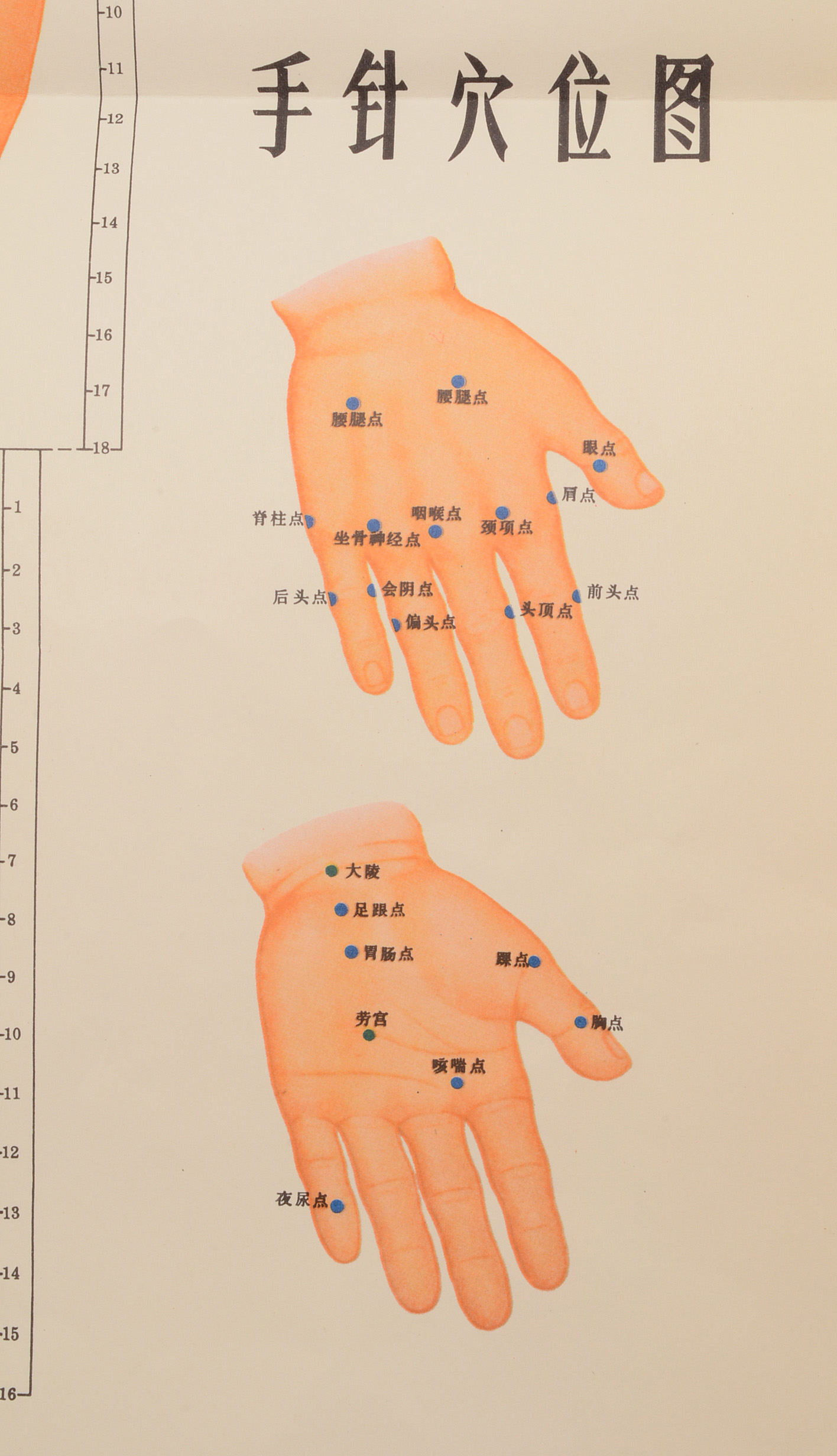 Vintage Chinese Acupuncture Chart