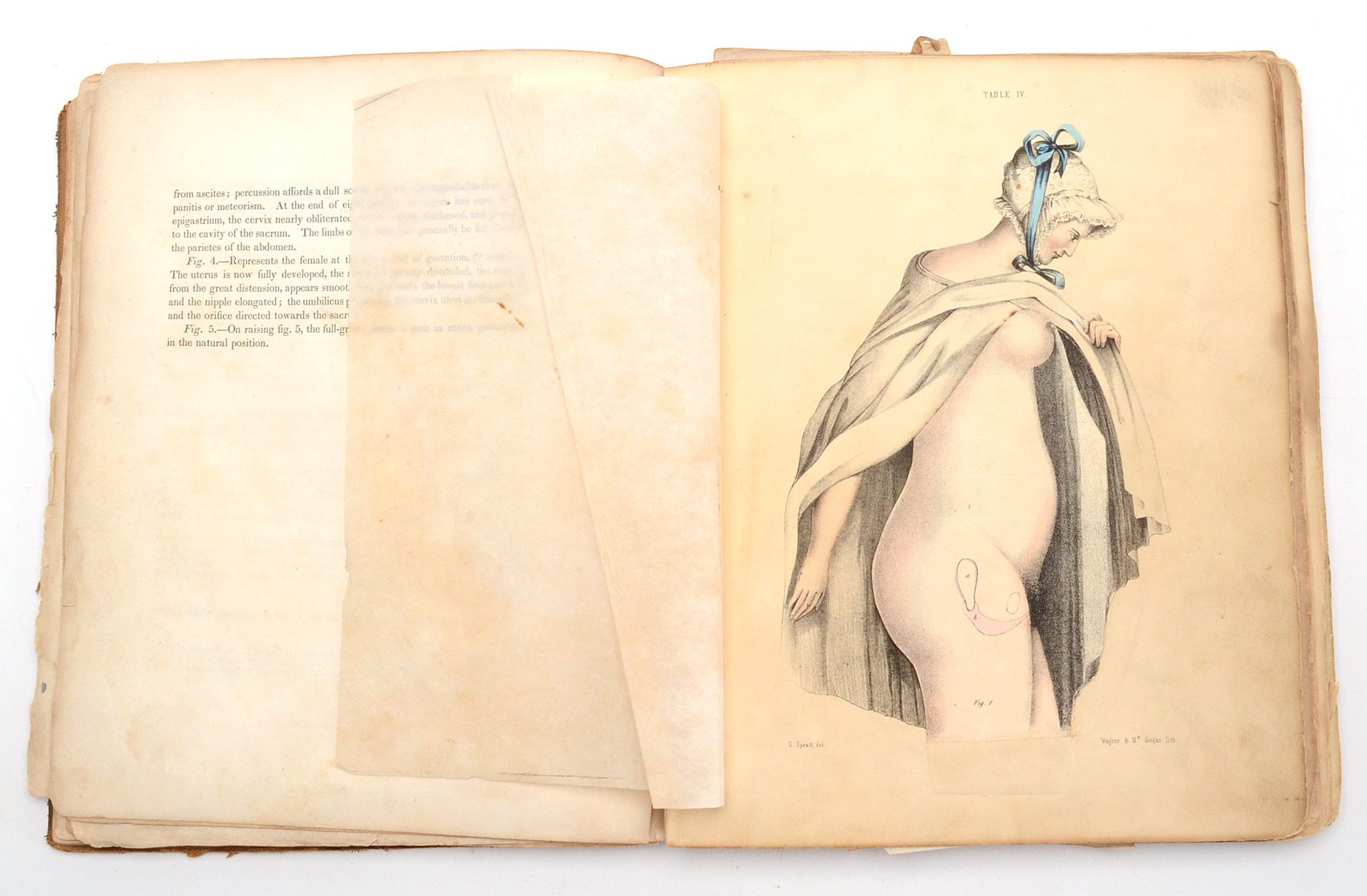 1850 Book on Midwifery and Obstetrics