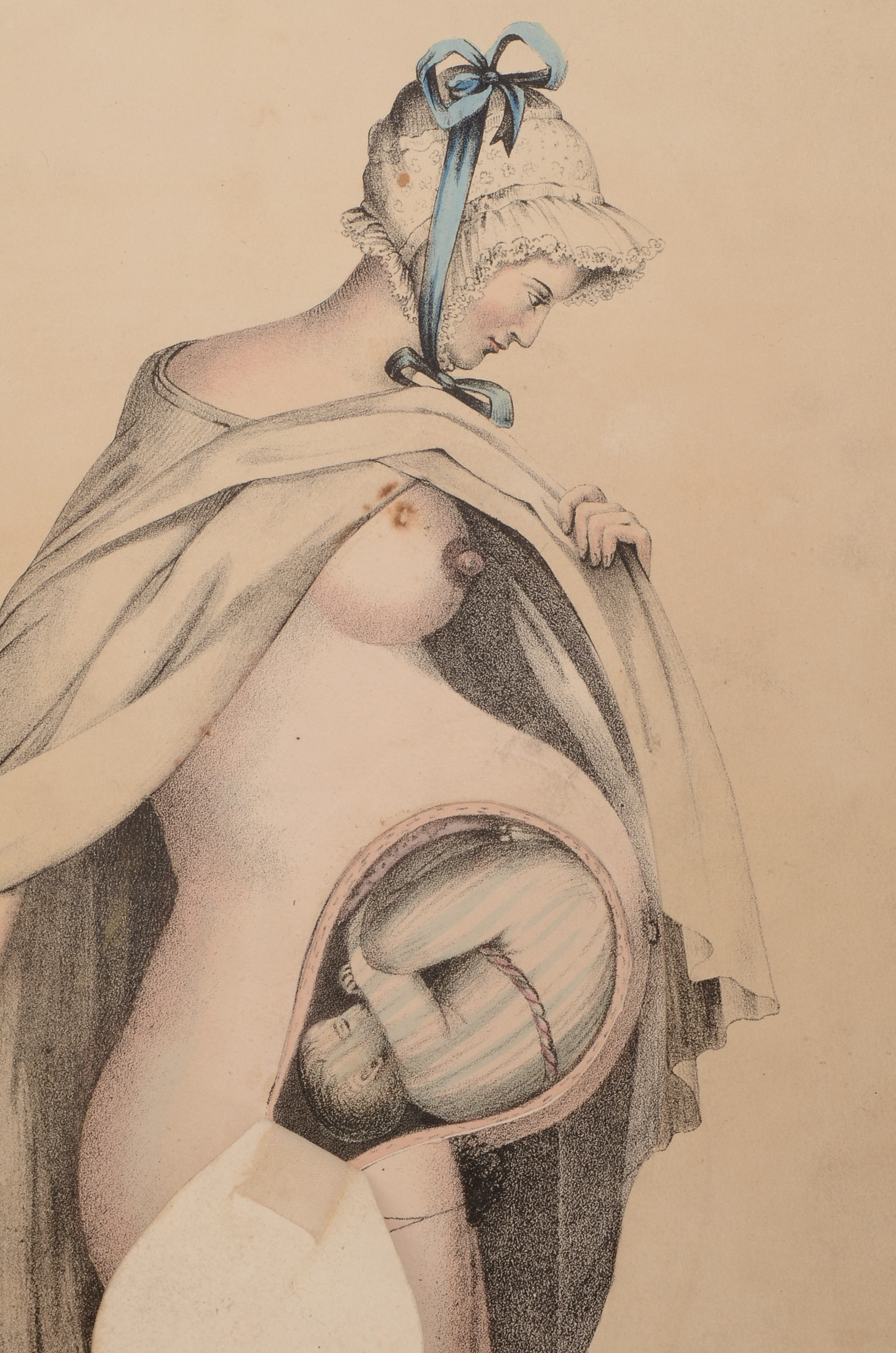 1850 Book on Midwifery and Obstetrics