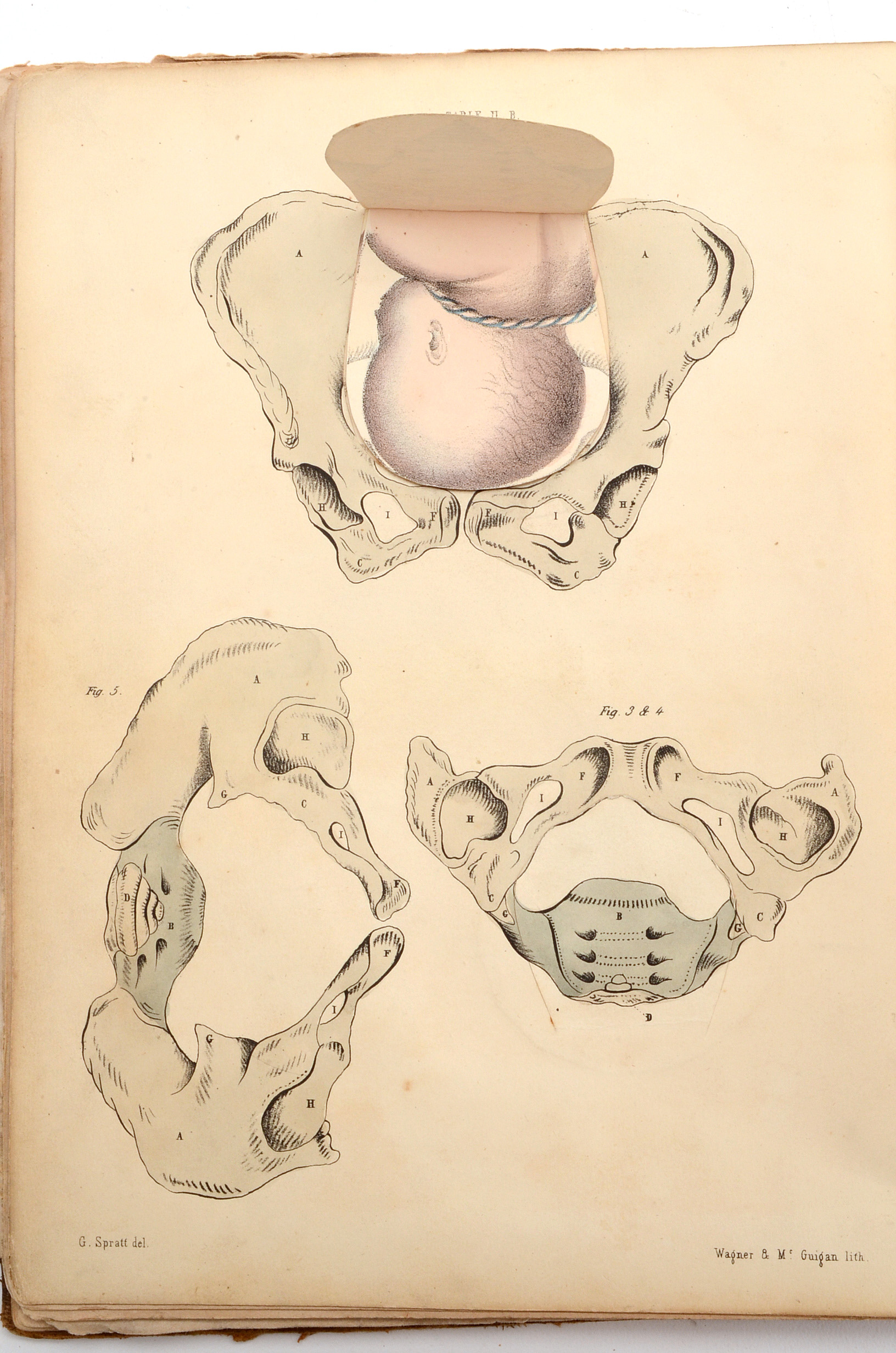 1850 Book on Midwifery and Obstetrics