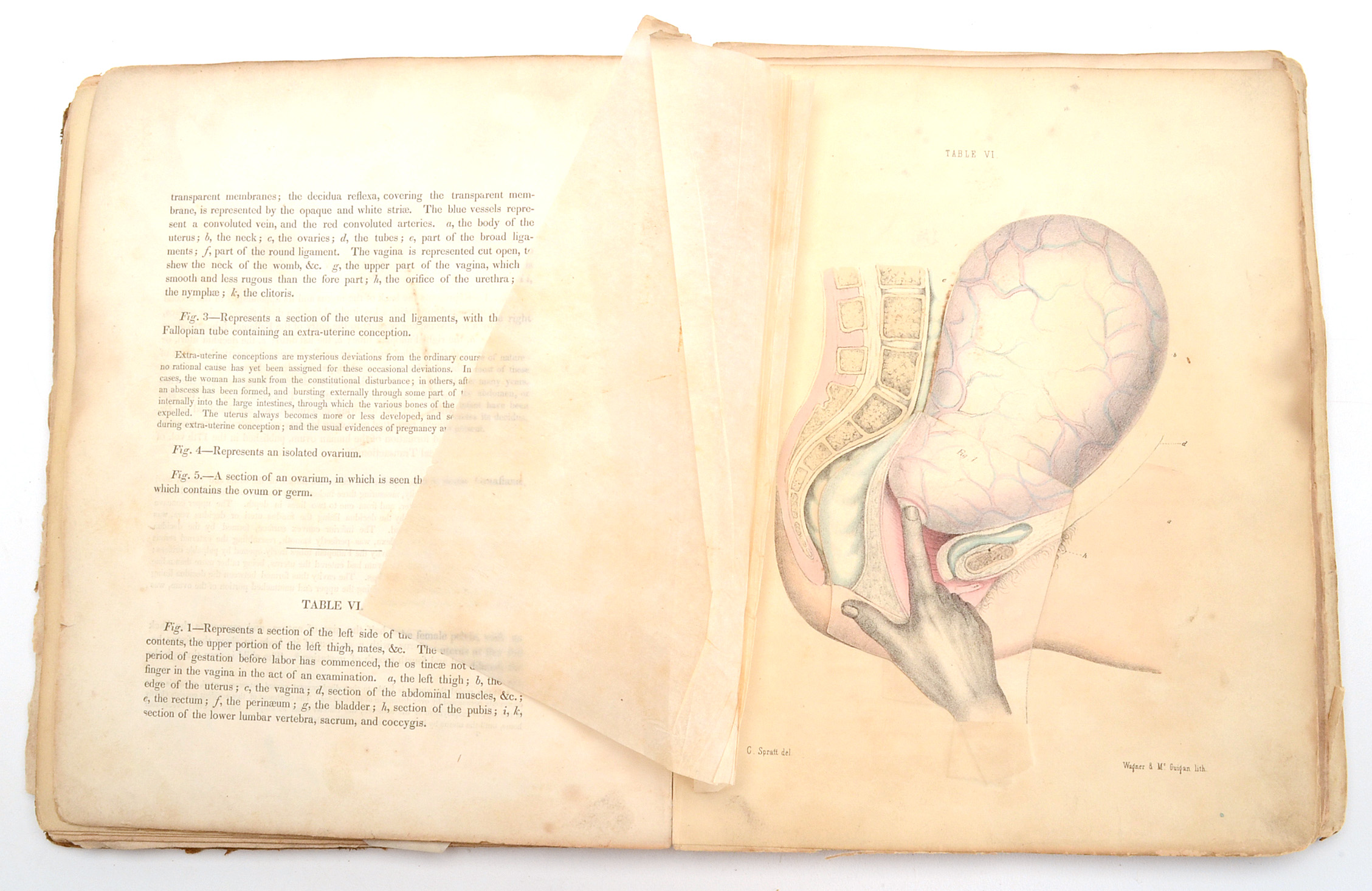 1850 Book on Midwifery and Obstetrics
