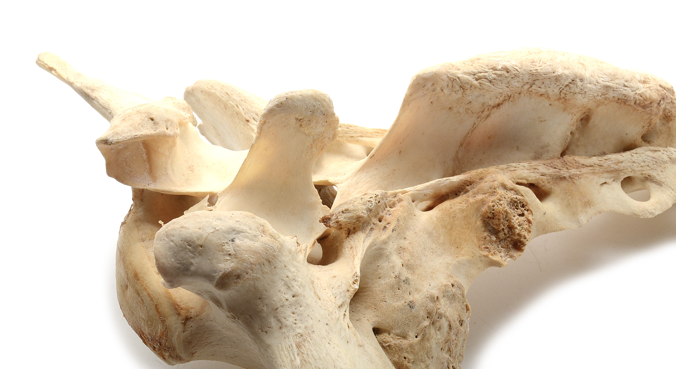 Two Moose Bones with Evidence of Healed Break