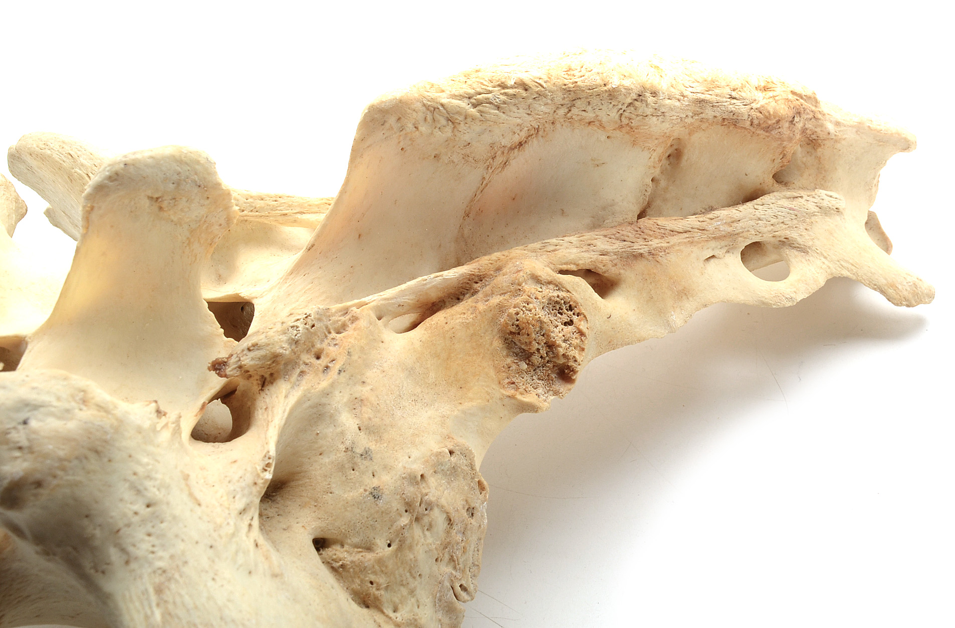 Two Moose Bones with Evidence of Healed Break