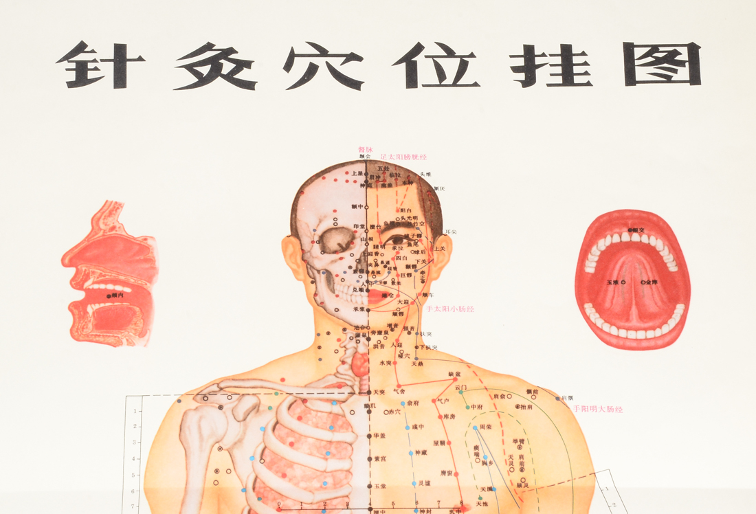 Vintage Chinese Acupuncture Chart