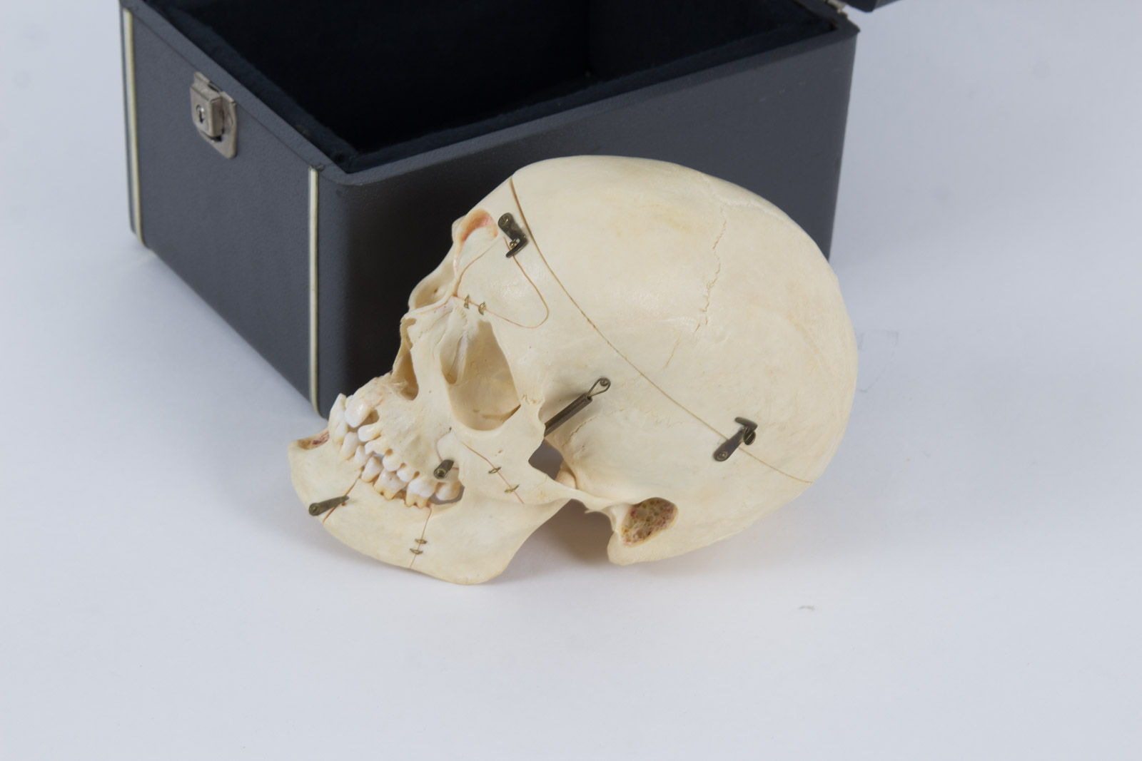 Kilgore International Model Human Skull