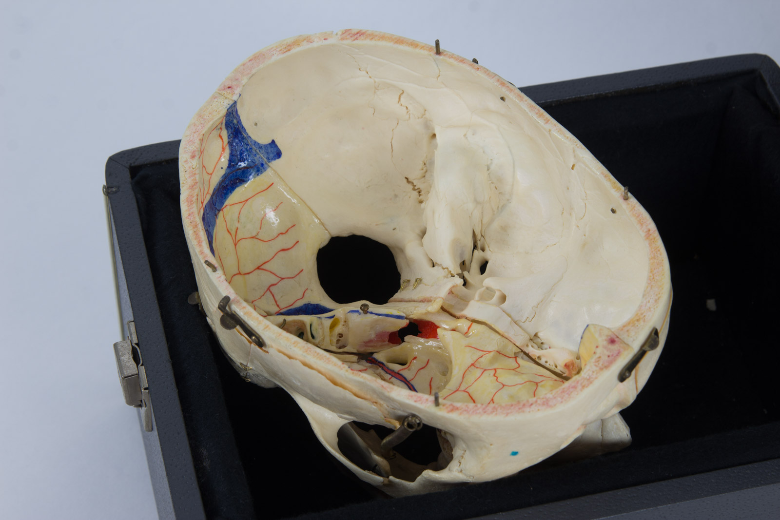 Kilgore International Model Human Skull