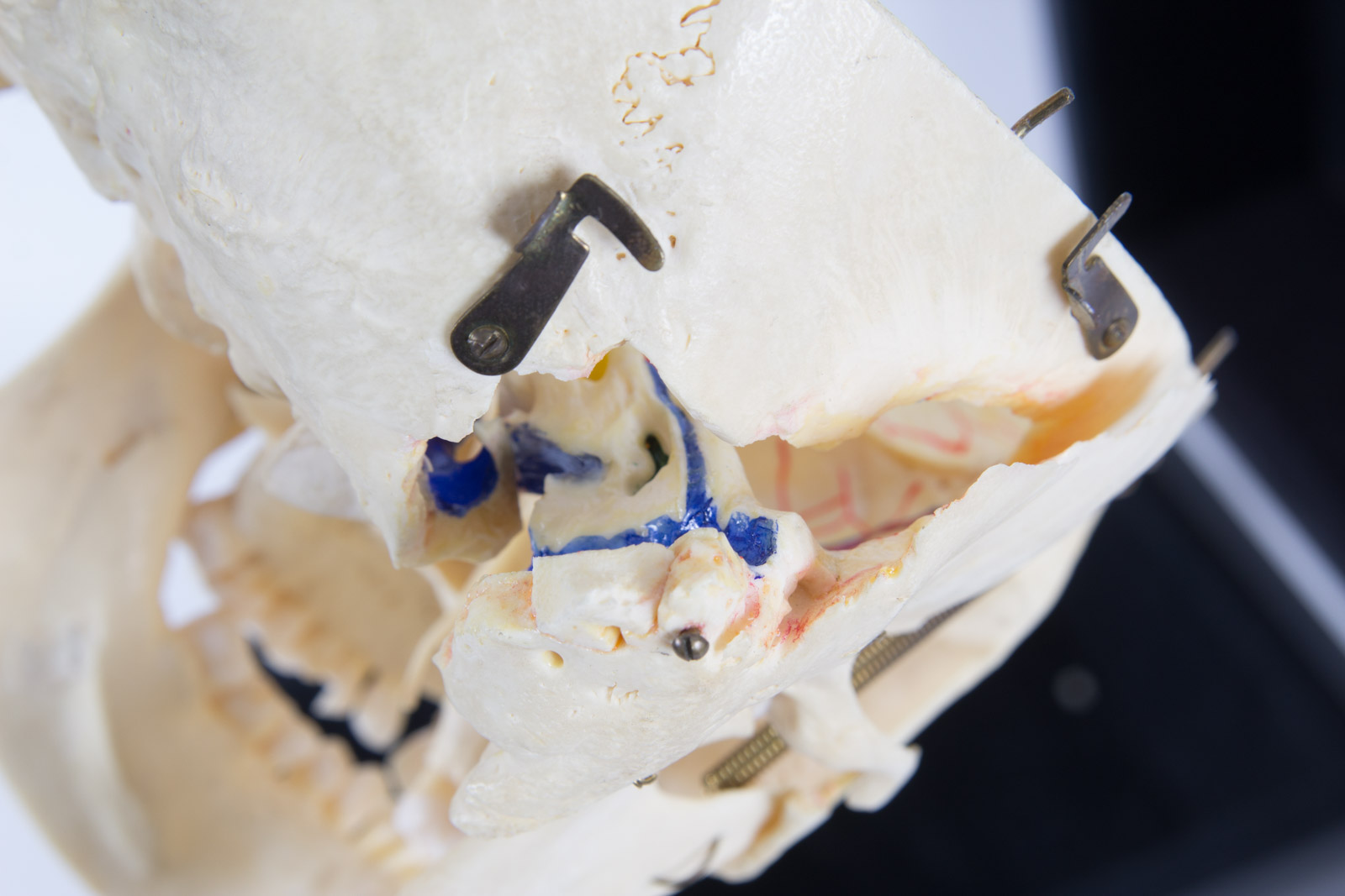 Kilgore International Model Human Skull