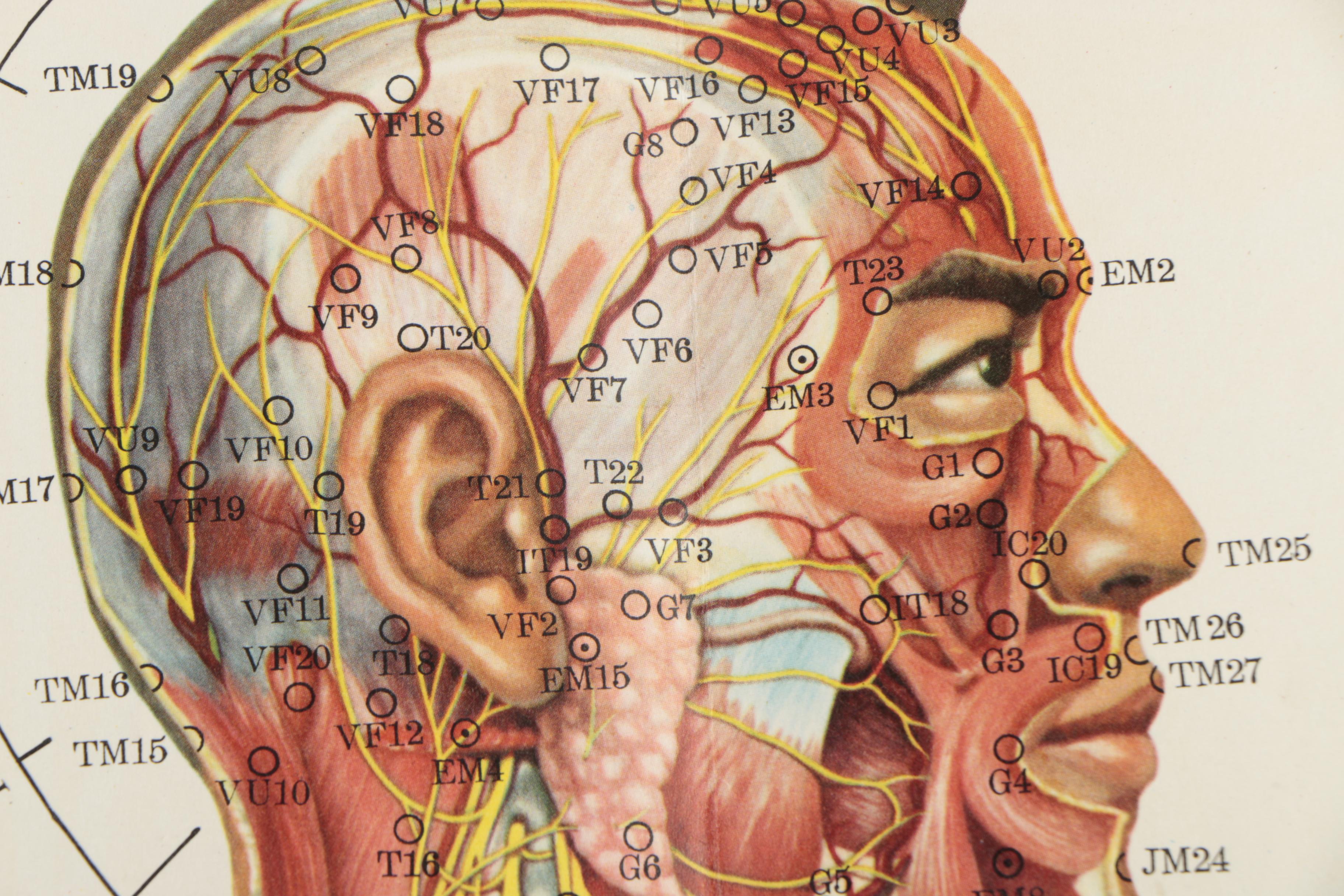 Offset Lithograph Poster of Anatomical Acupuncture Medical Chart