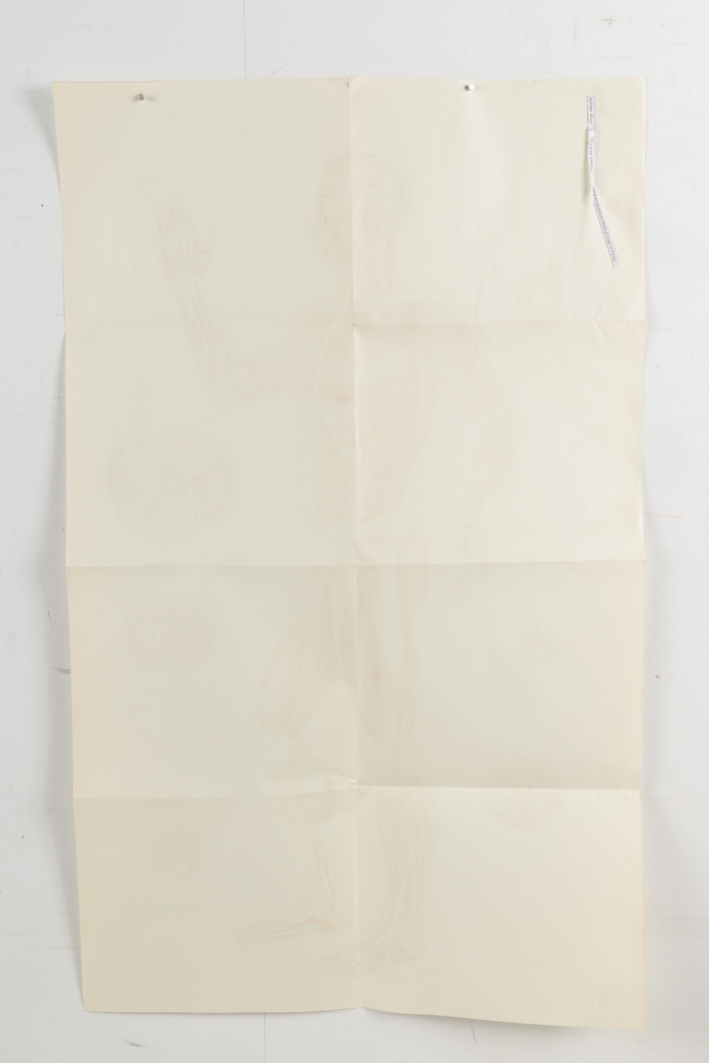 Offset Lithograph Poster of Anatomical Acupuncture Medical Chart