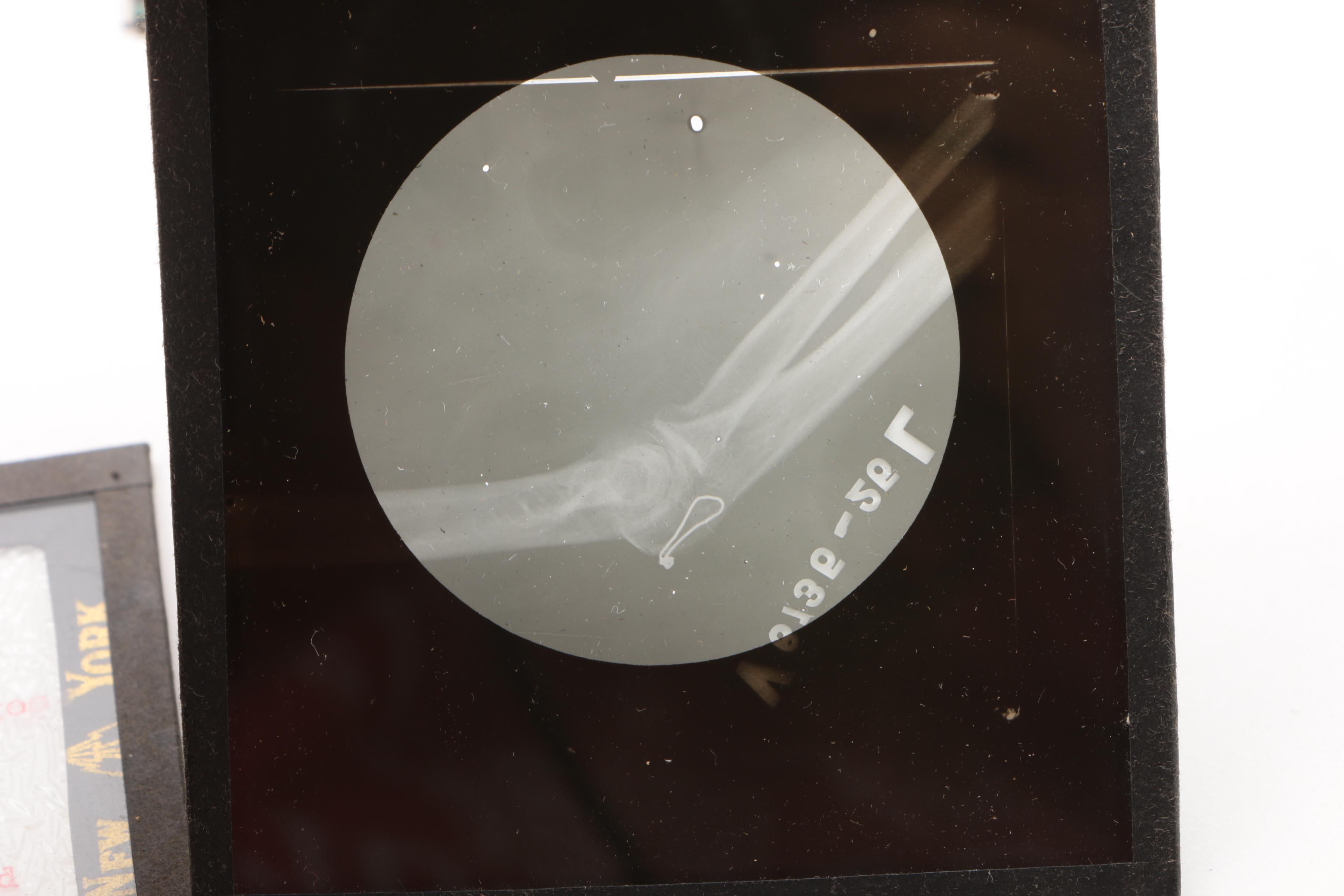 1930s Radio-Mat Slide Co., Eastman and Other Medical Study Lantern Slides