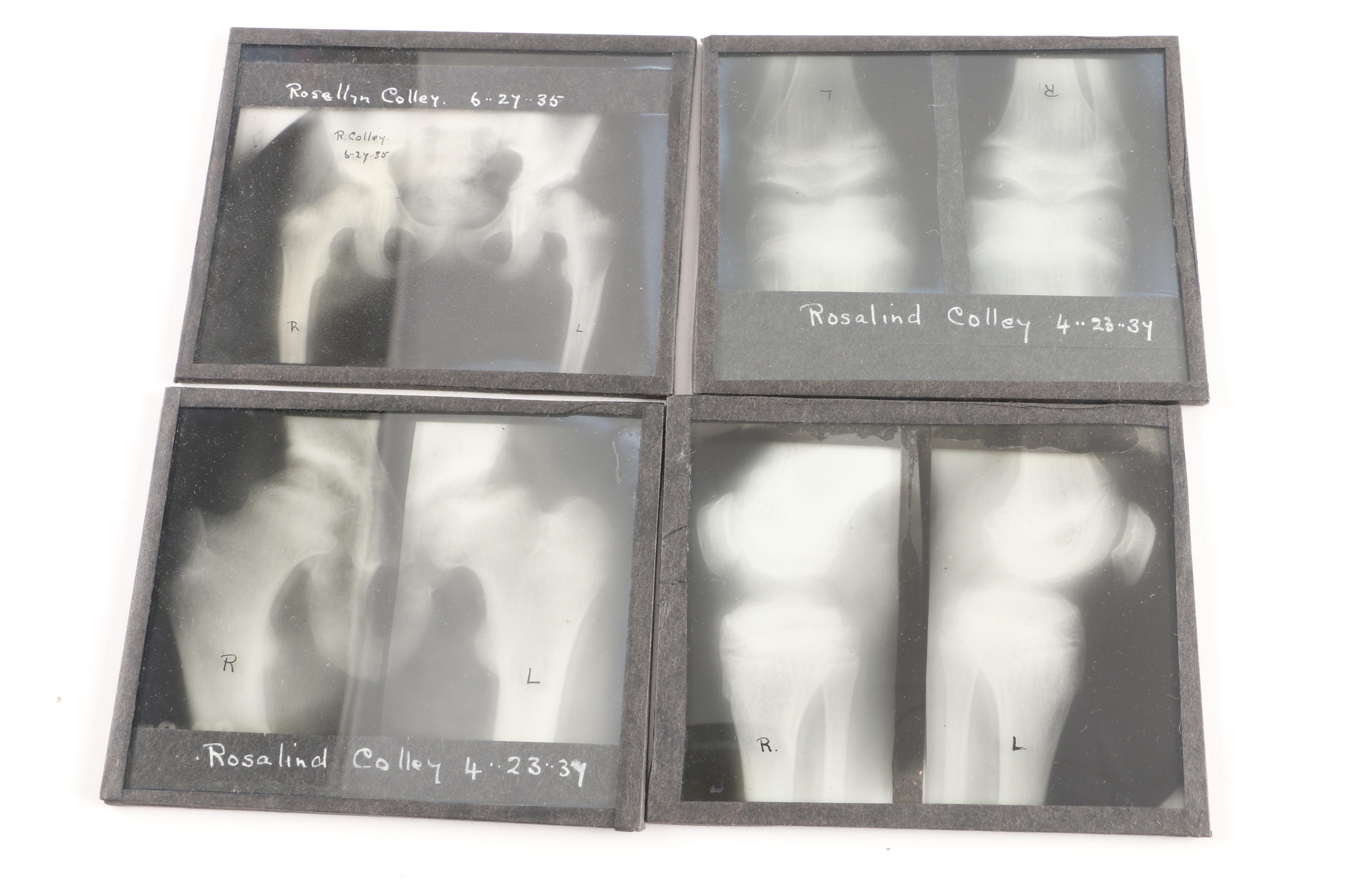 1930s Radio-Mat Slide Co. and Other Medical Lantern Slides