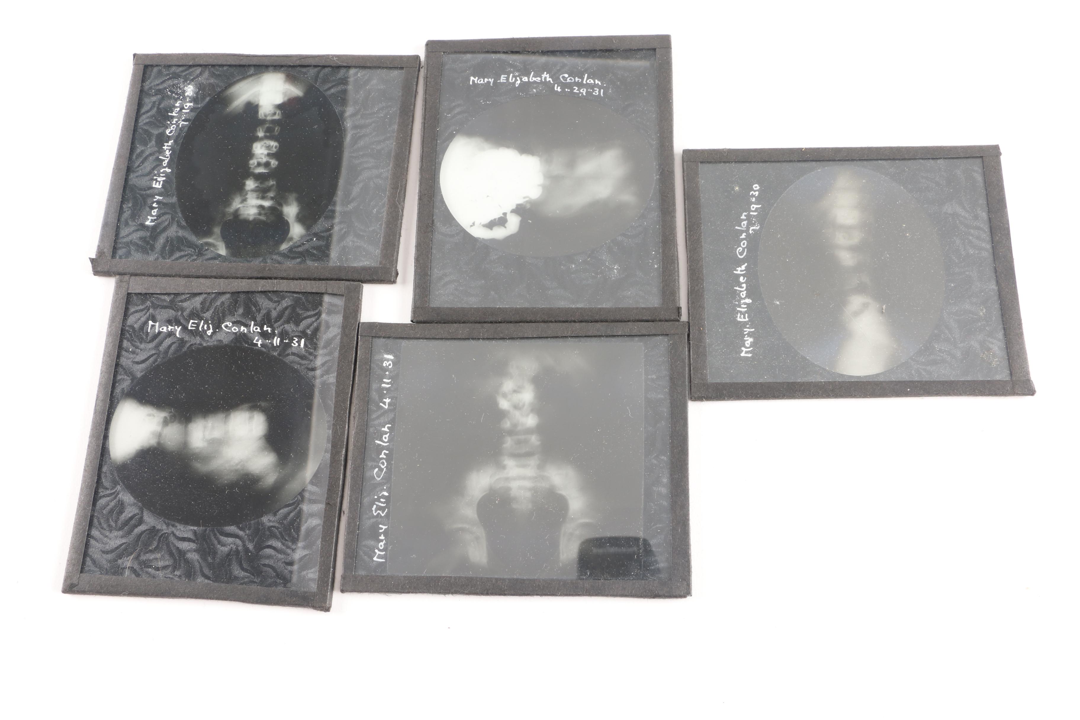 1930s Radio-Mat Slide Co. and Other Medical Lantern Slides