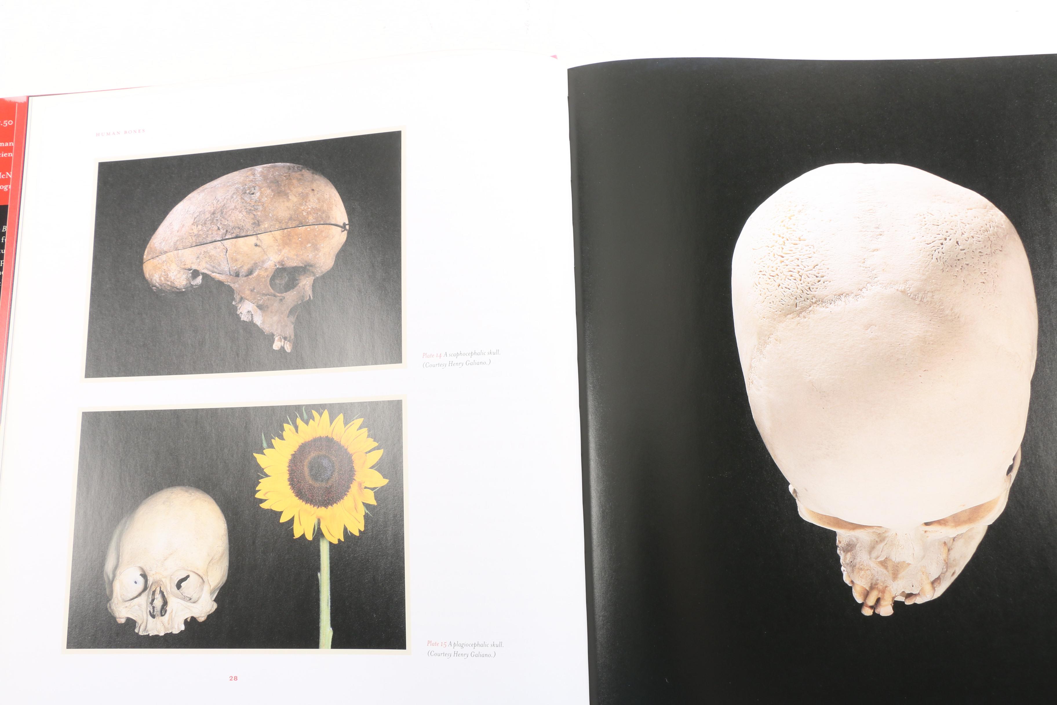 Two Books on Human Bones