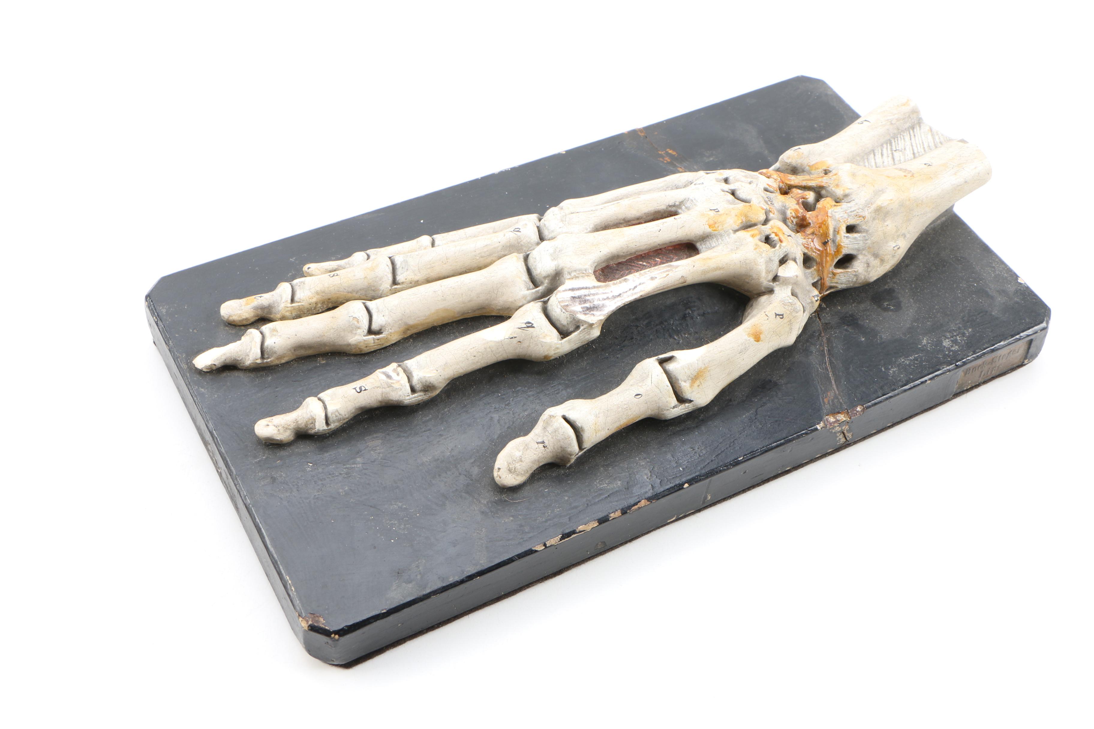 Bock-Steger Plaster Anatomical Model of Skeletal Hand, Late 19th Century