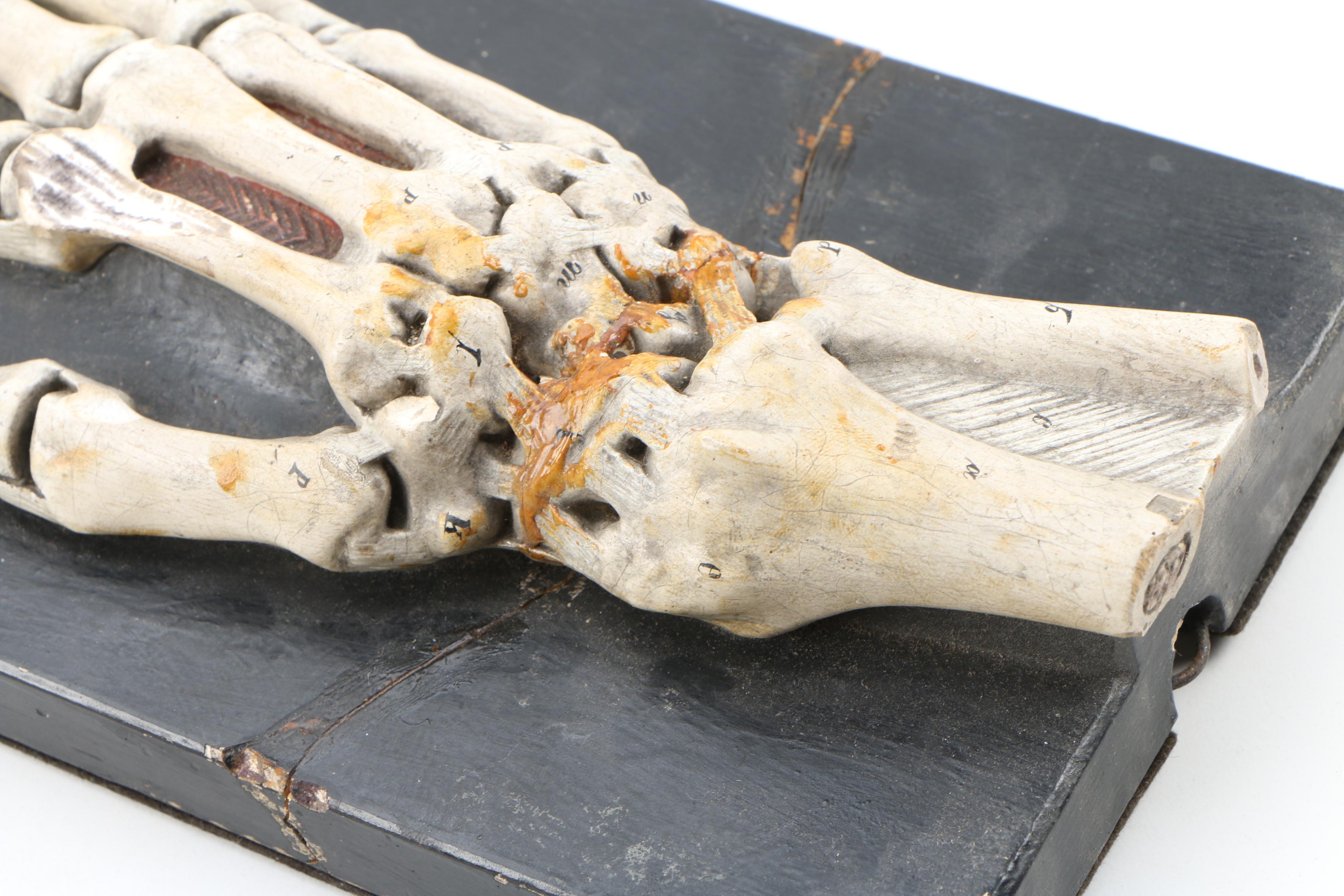 Bock-Steger Plaster Anatomical Model of Skeletal Hand, Late 19th Century