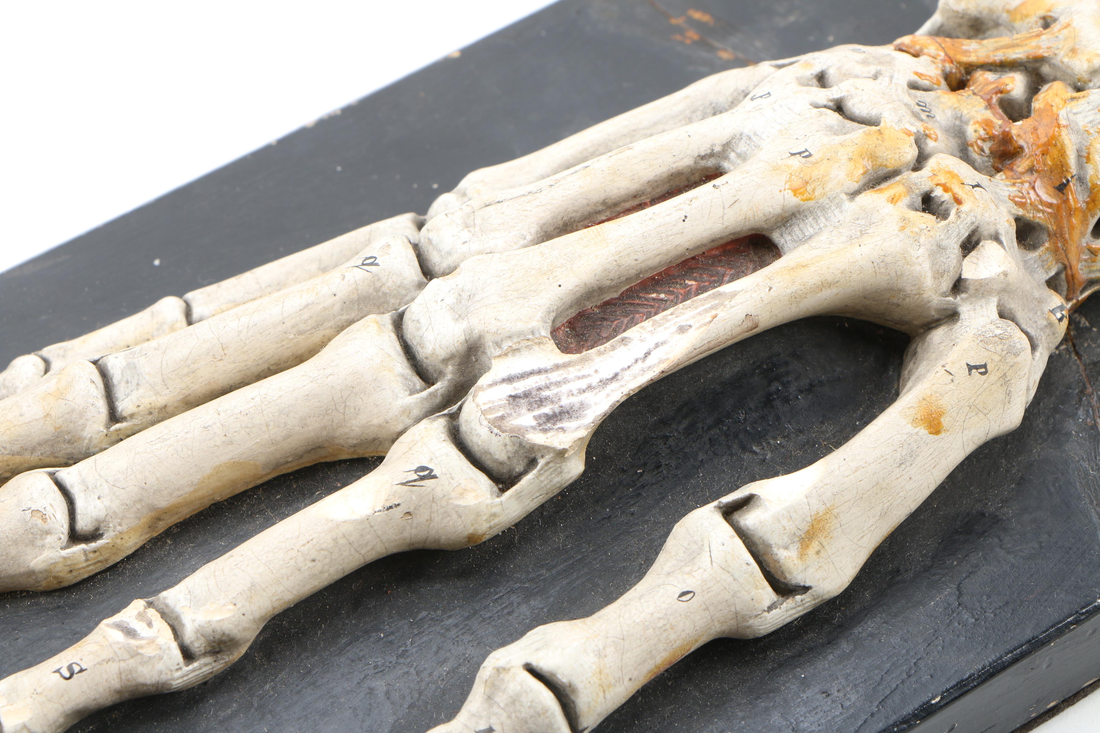 Bock-Steger Plaster Anatomical Model of Skeletal Hand, Late 19th Century