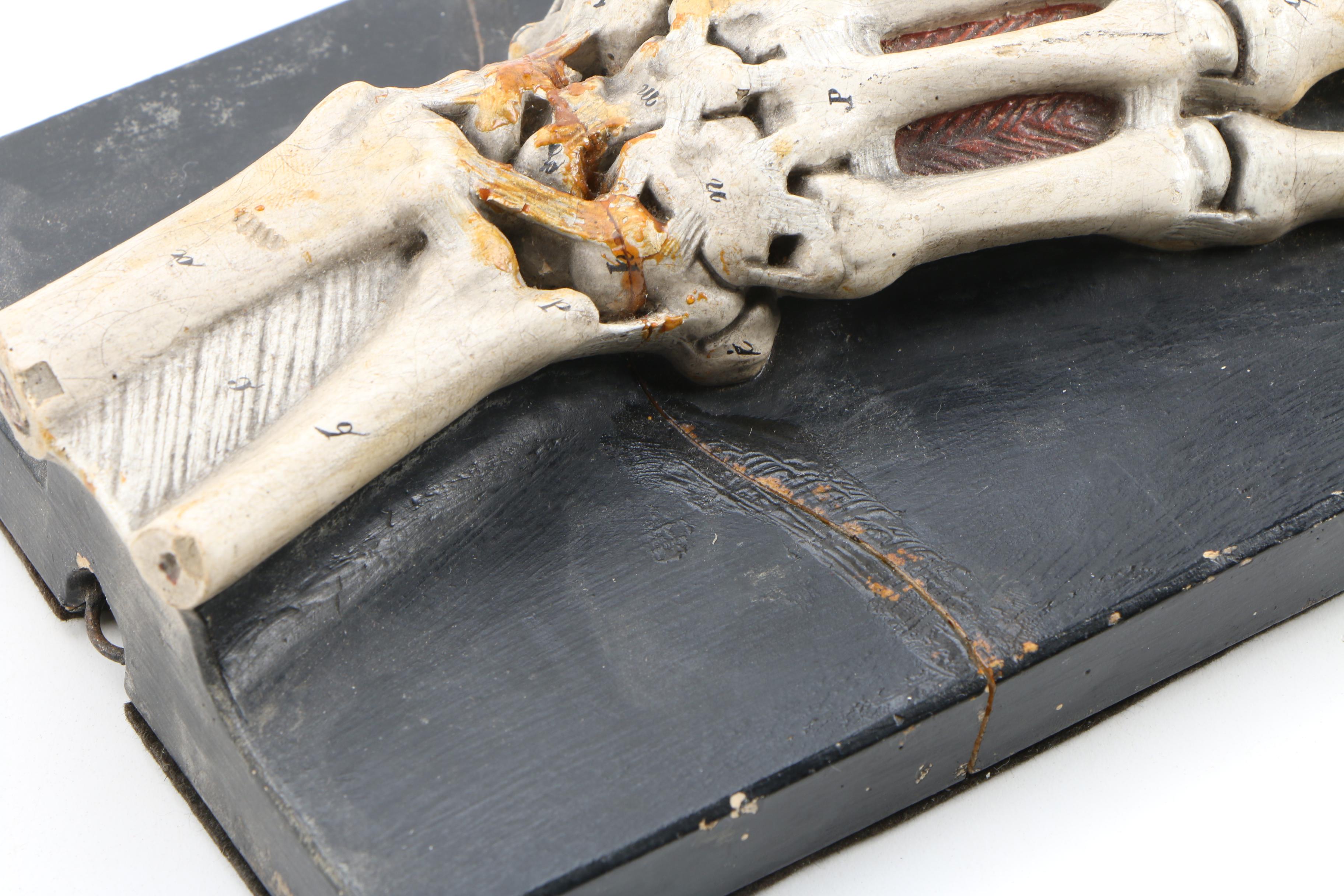 Bock-Steger Plaster Anatomical Model of Skeletal Hand, Late 19th Century