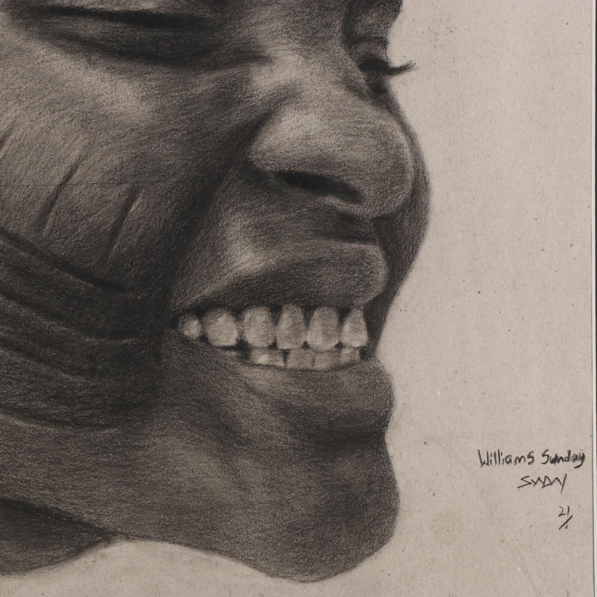 Williams Sunday Portrait Charcoal Drawing of Child with Scarred Cheeks, 2021
