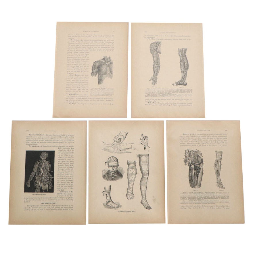 Lithographs of Medical Illustrations, Early 20th Century