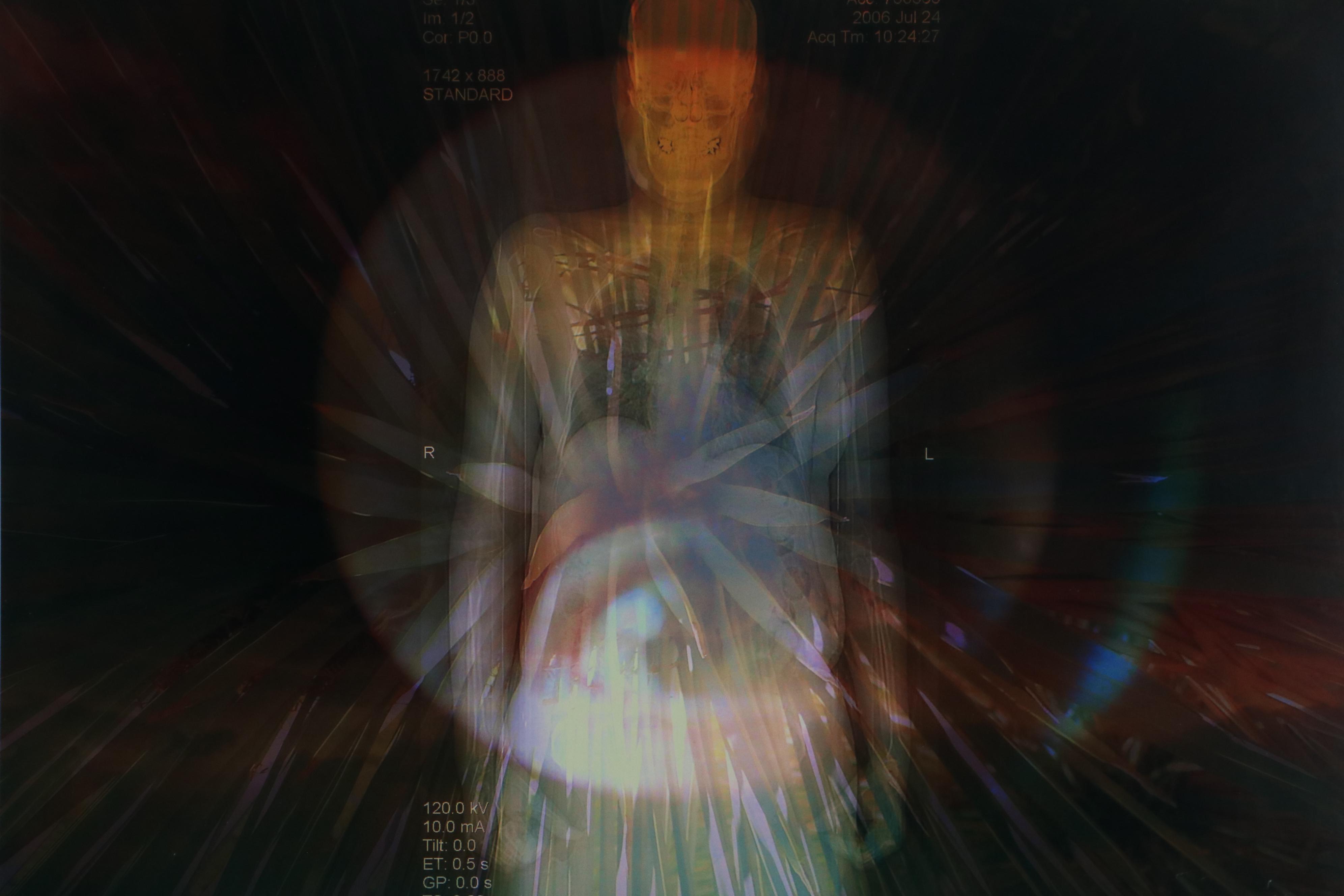 Sarah Roush Digital Collages "Ted's Eye," Late 20th Century