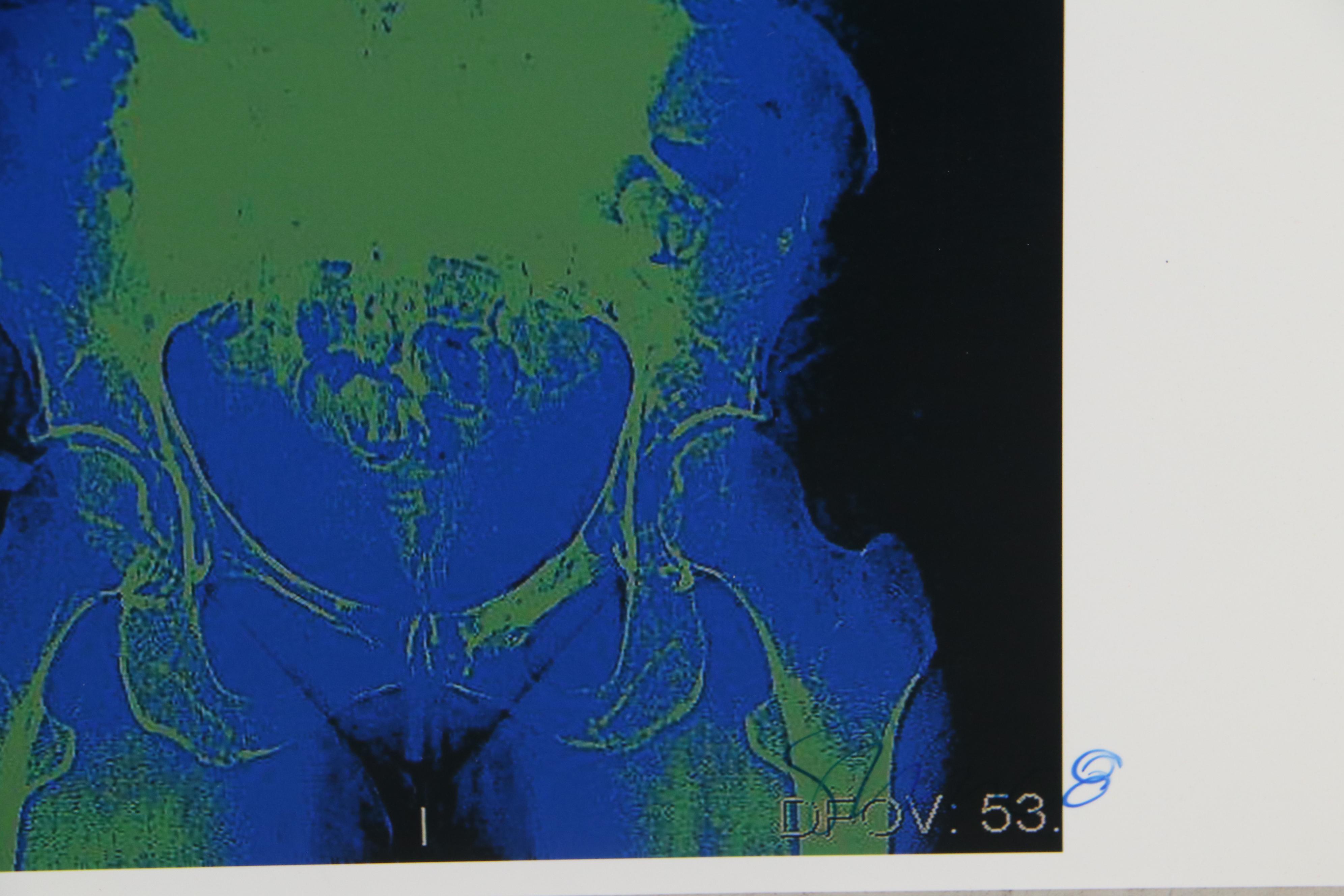 Sarah Roush Digital Collage "Hibiscus," 2008