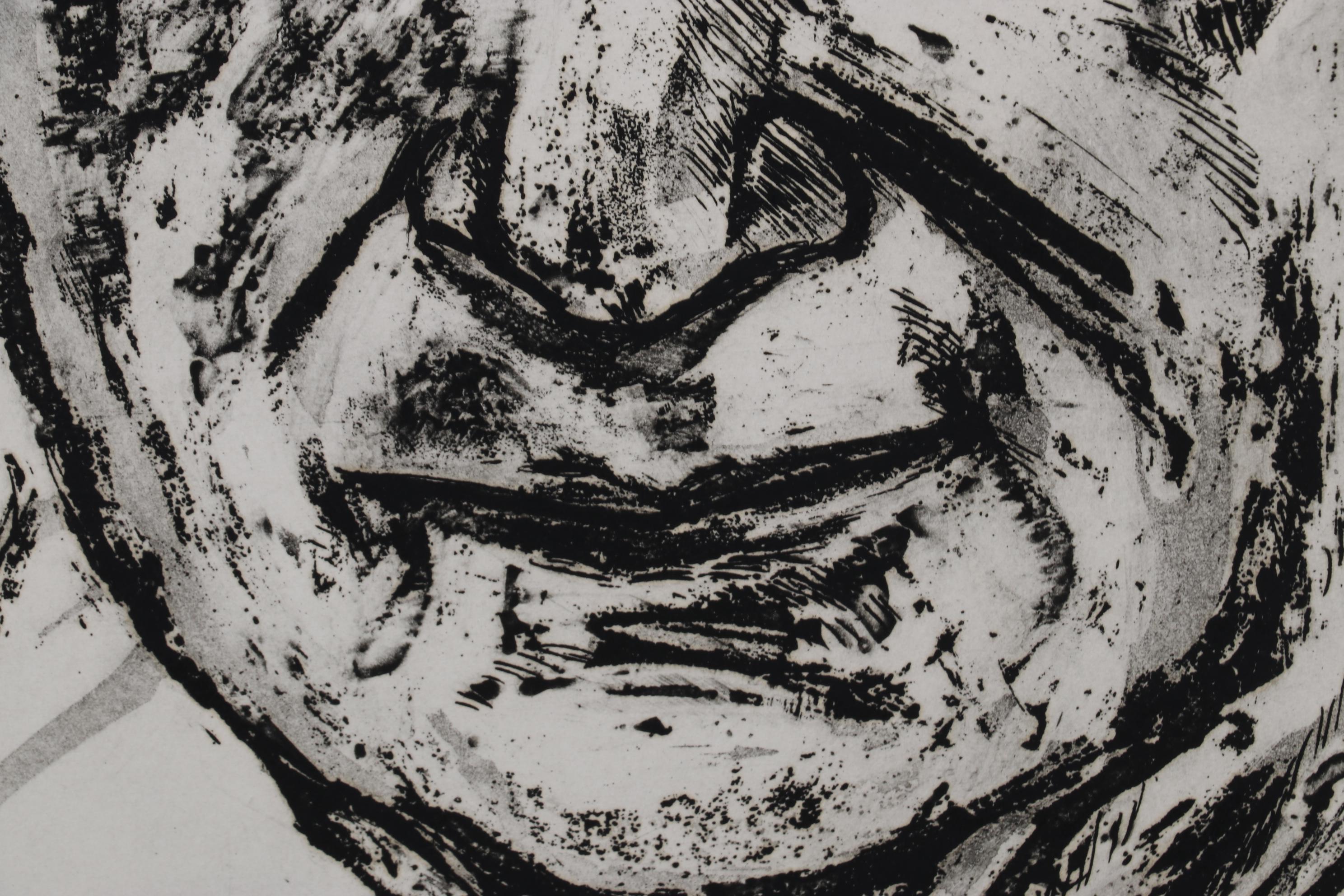 Sidney Chafetz Etching With Aquatint "Dr. Robert M. Zollinger," 1974