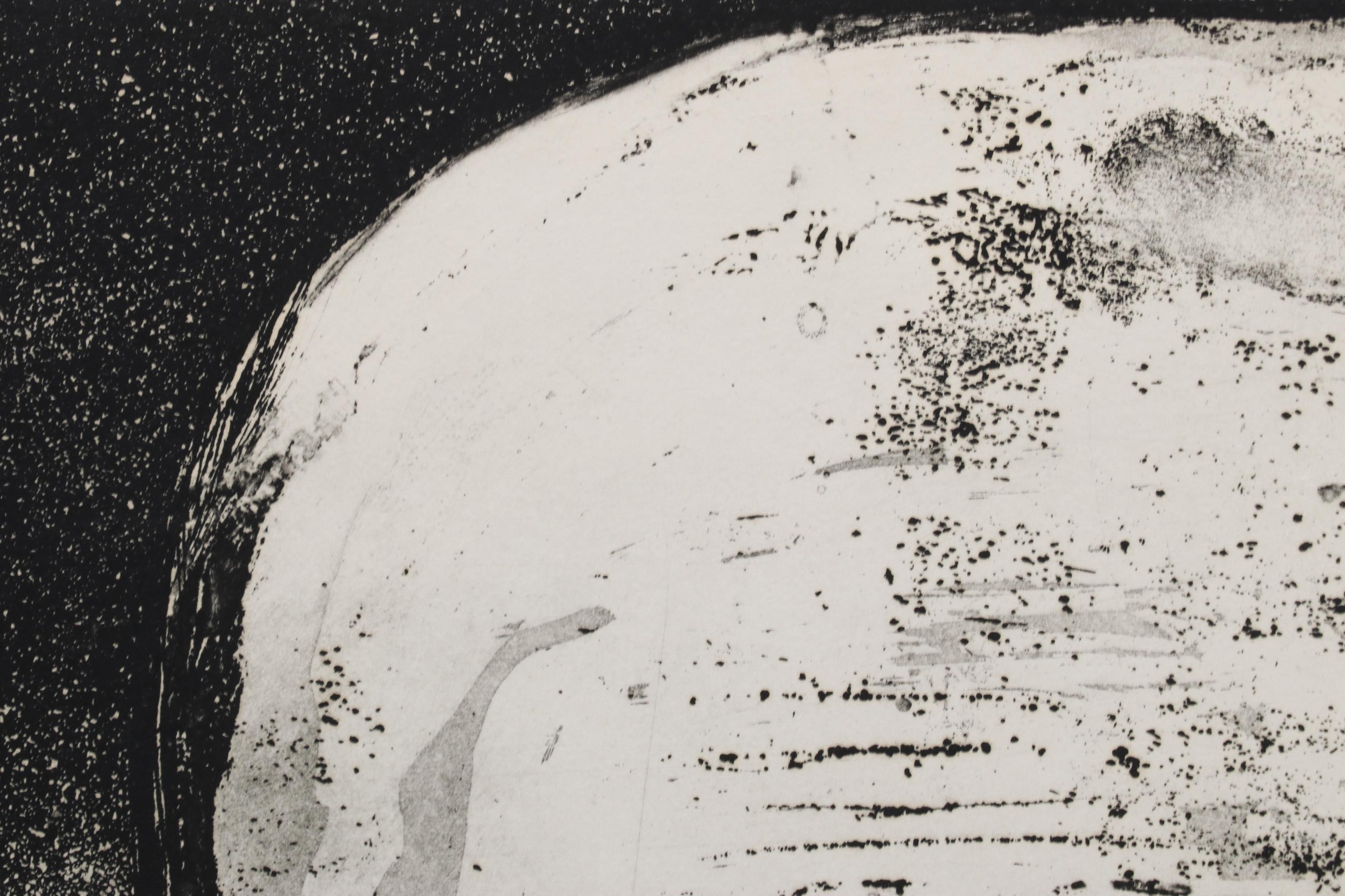 Sidney Chafetz Etching With Aquatint "Dr. Robert M. Zollinger," 1974