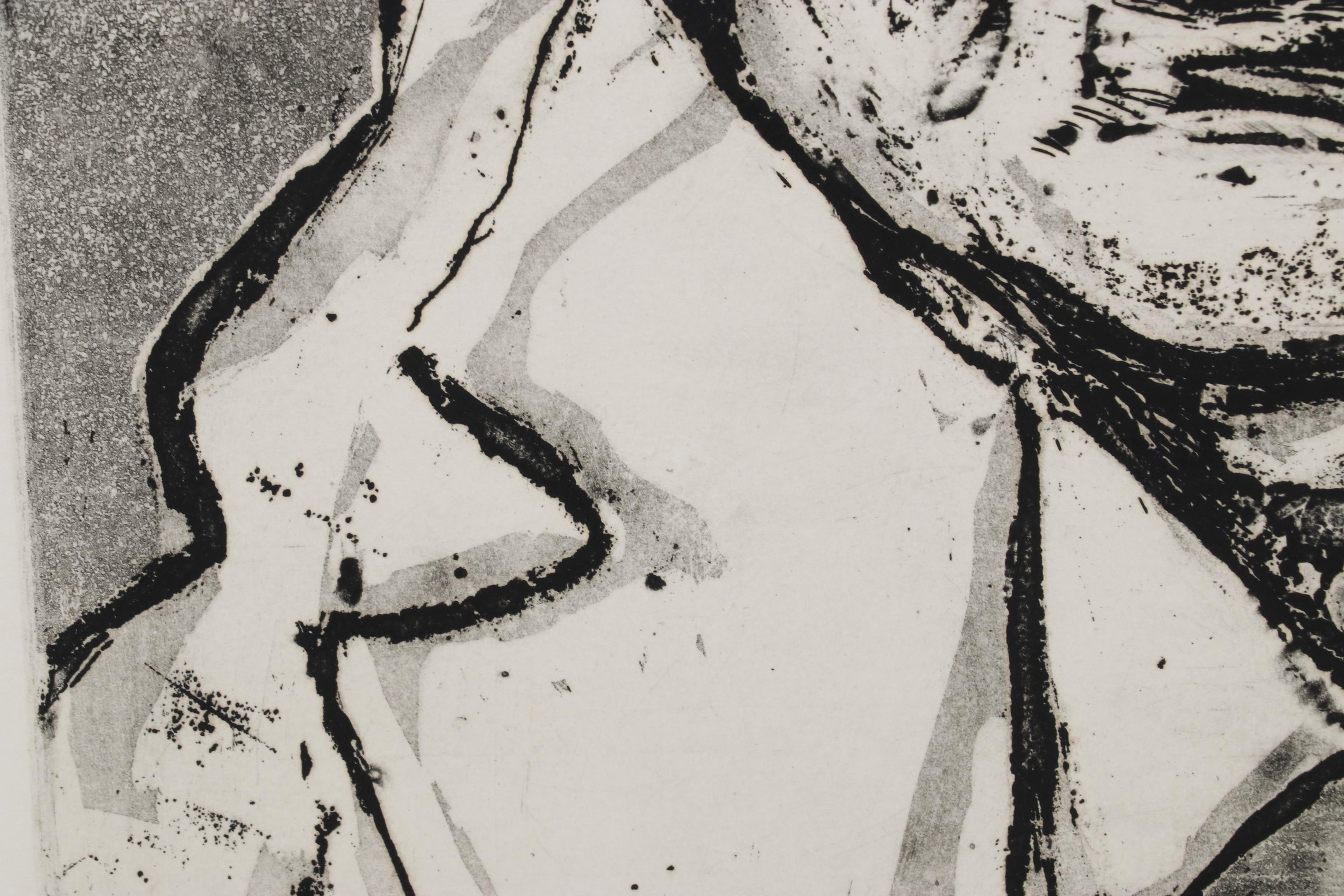 Sidney Chafetz Etching With Aquatint "Dr. Robert M. Zollinger," 1974