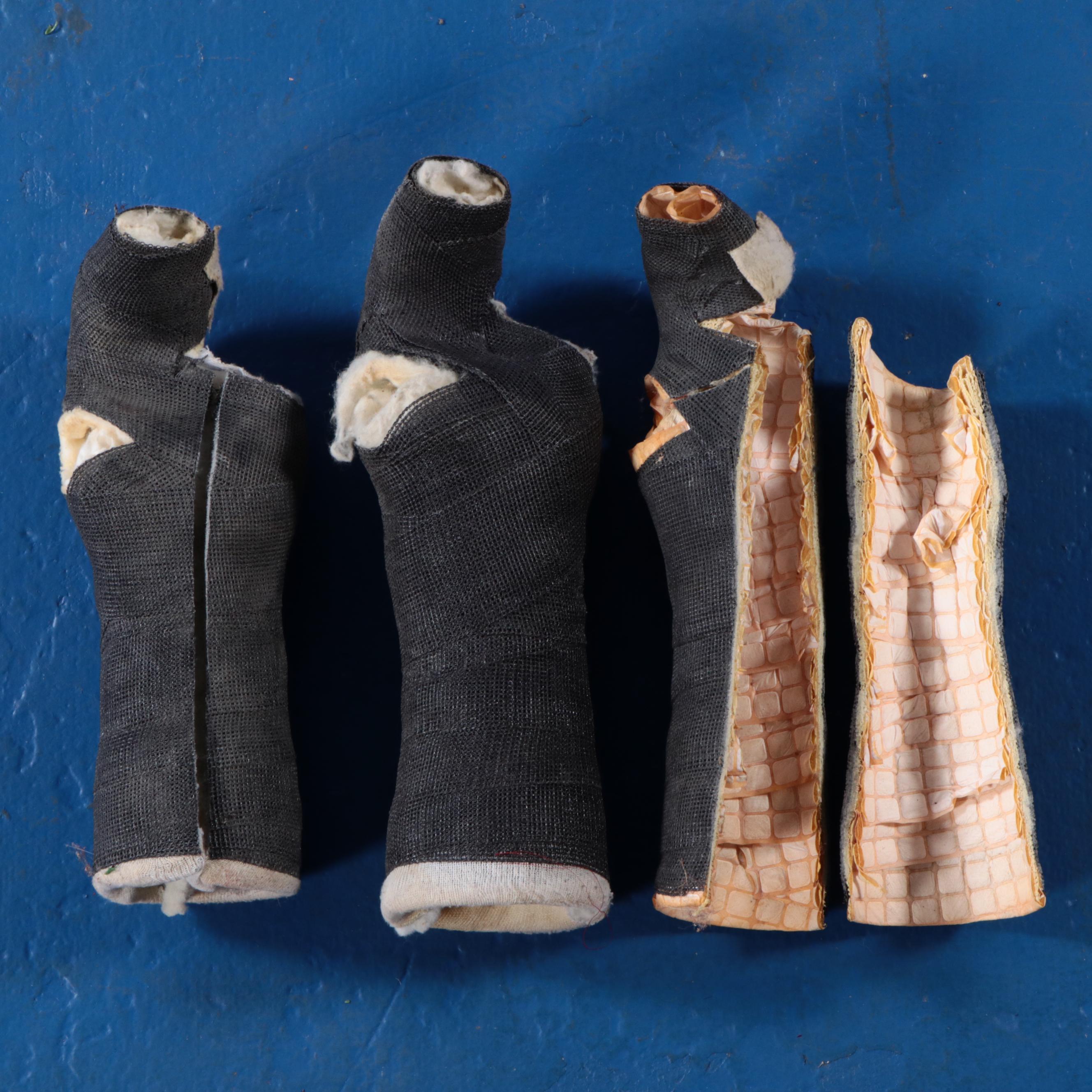 Jack White's Finger Casts