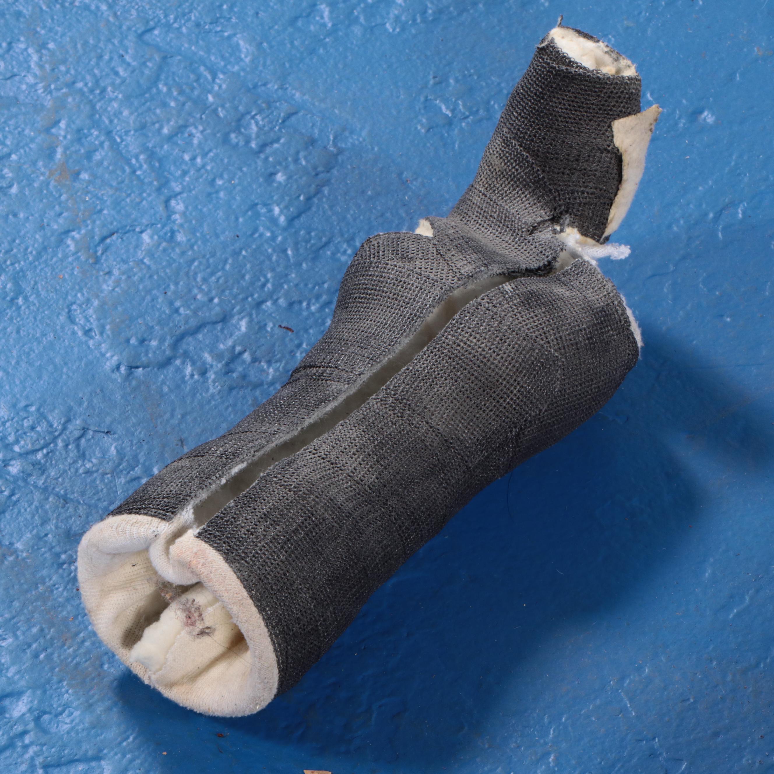 Jack White's Finger Casts