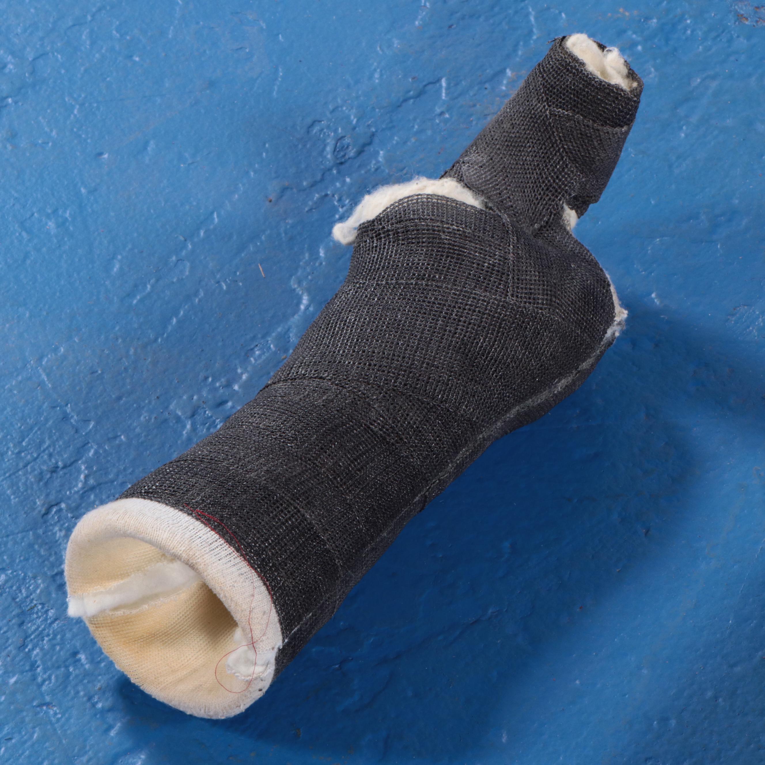 Jack White's Finger Casts