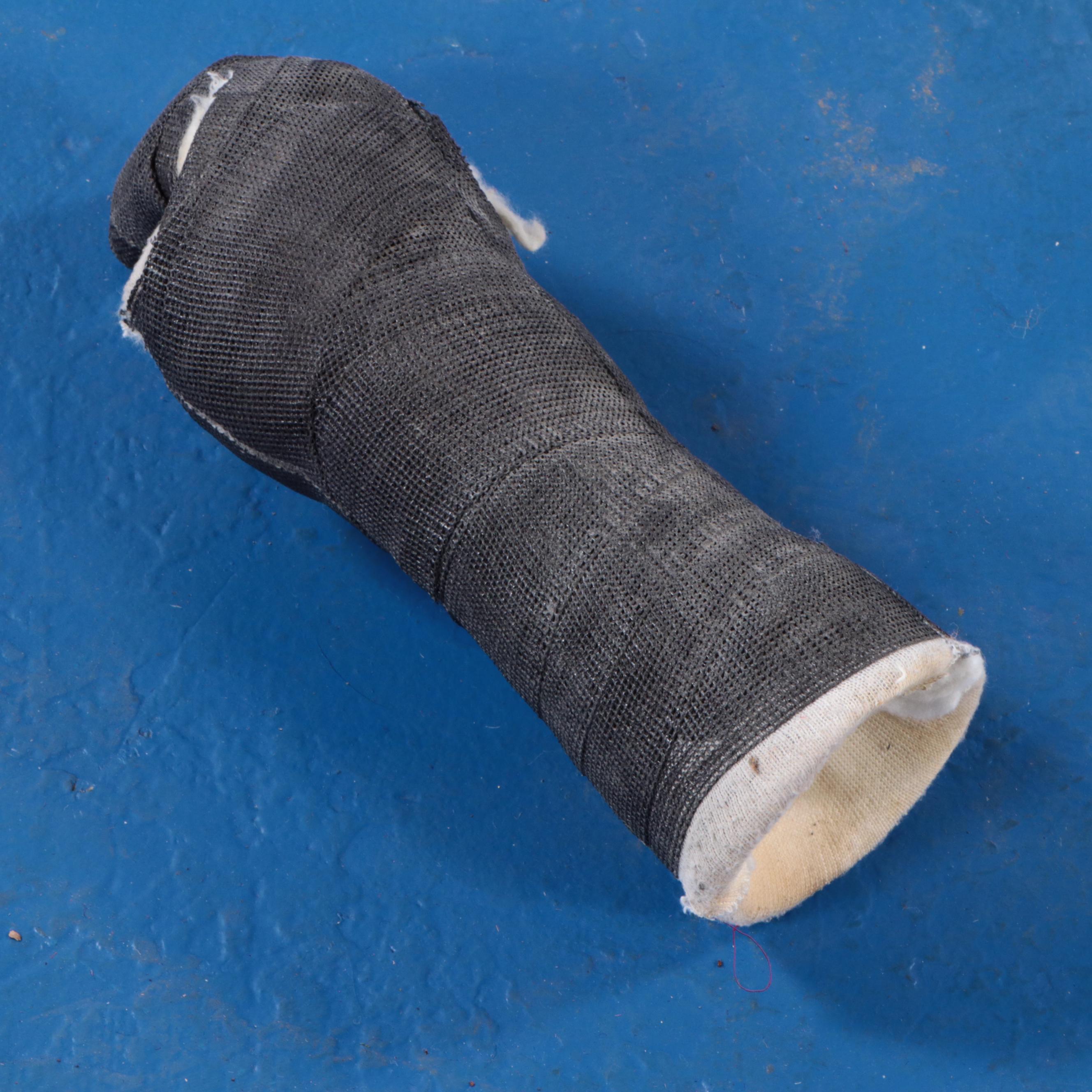 Jack White's Finger Casts